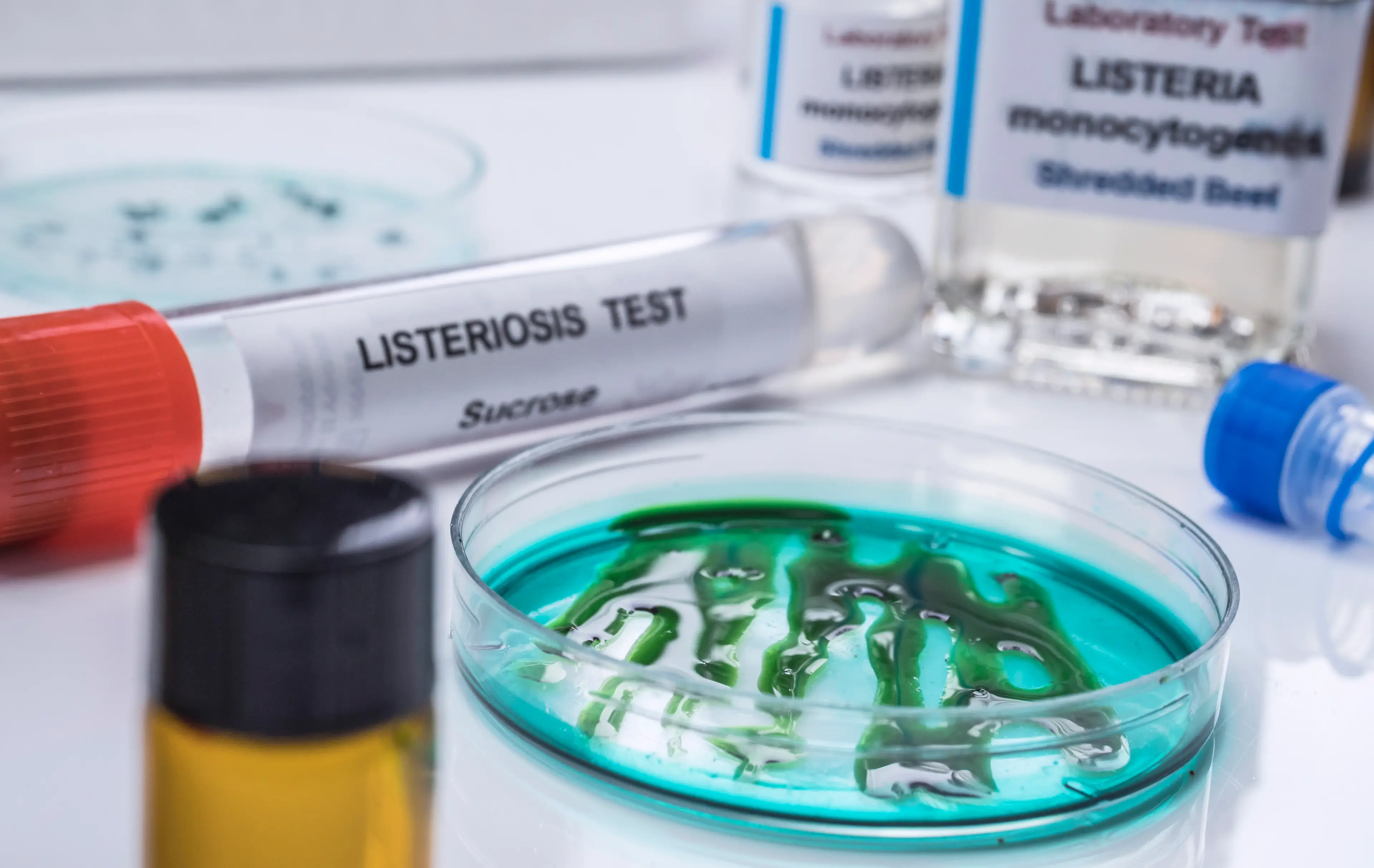 A listeriosis outbreak from 2025 has been linked to ready meals (Getty Stock Image)
