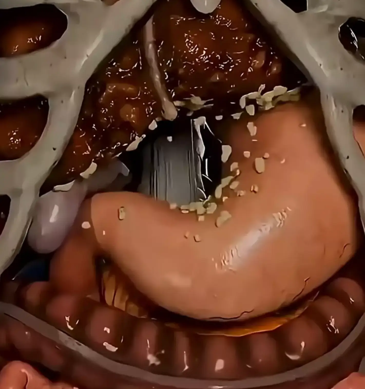 A simulation has now shown how the body reacts after no food for 72 hours. (YouTube/MedBright)