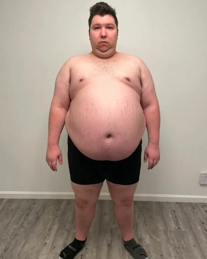 (Instagram/@real_nikocado)