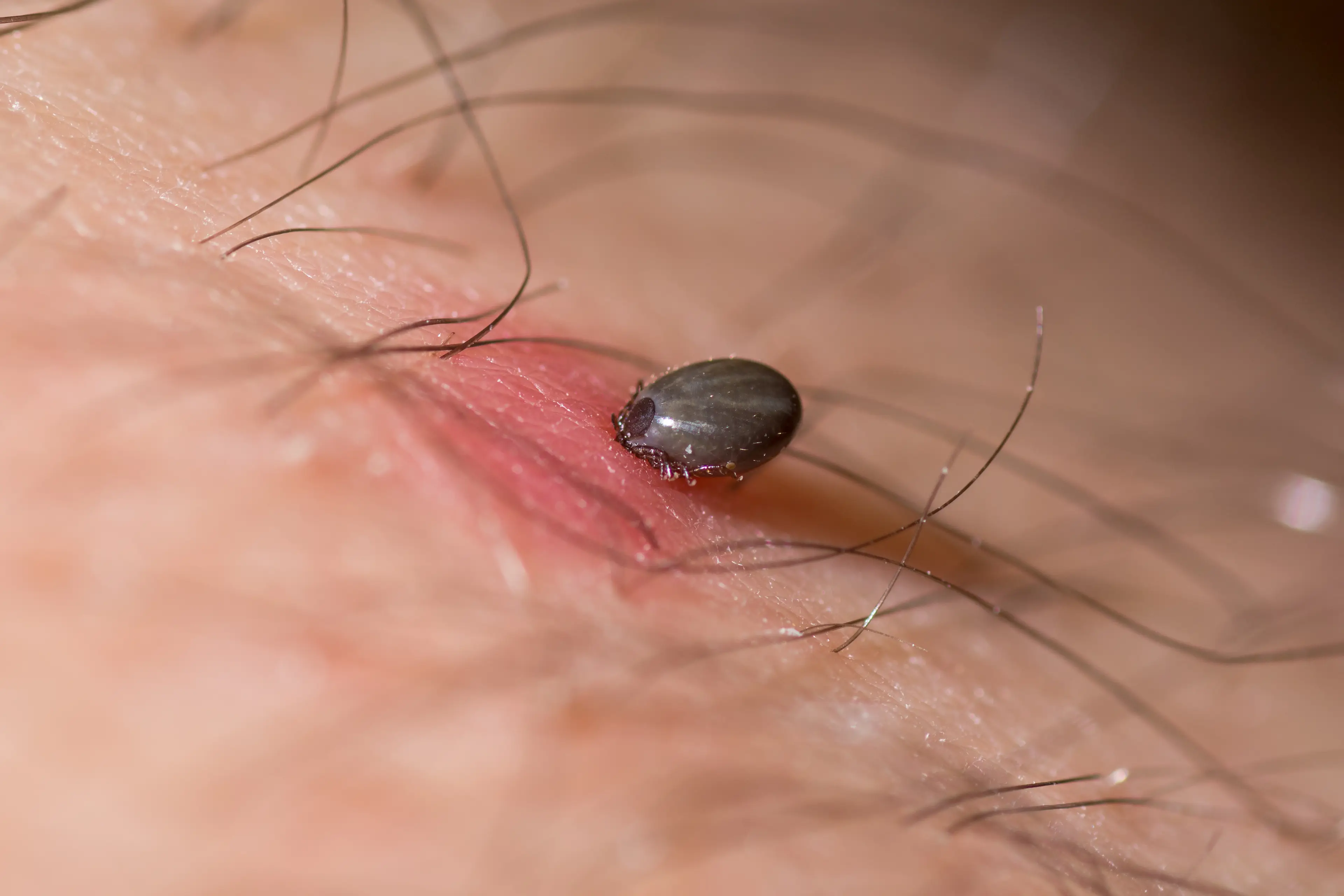 Ticks swell up as they feast on your blood (Ian_Redding/Getty Images)