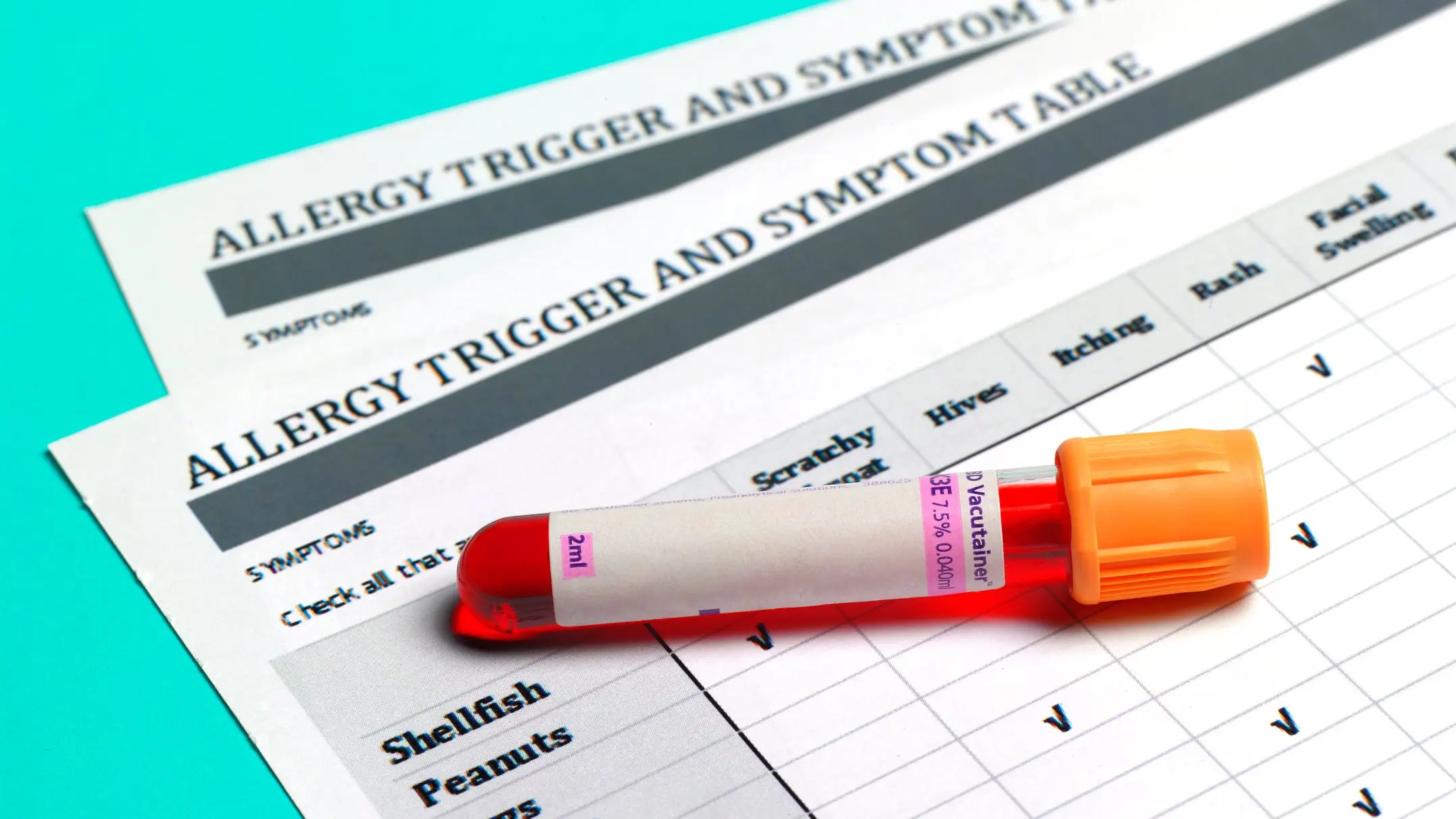 'Life-changing' food allergy drug is already having huge impact on people