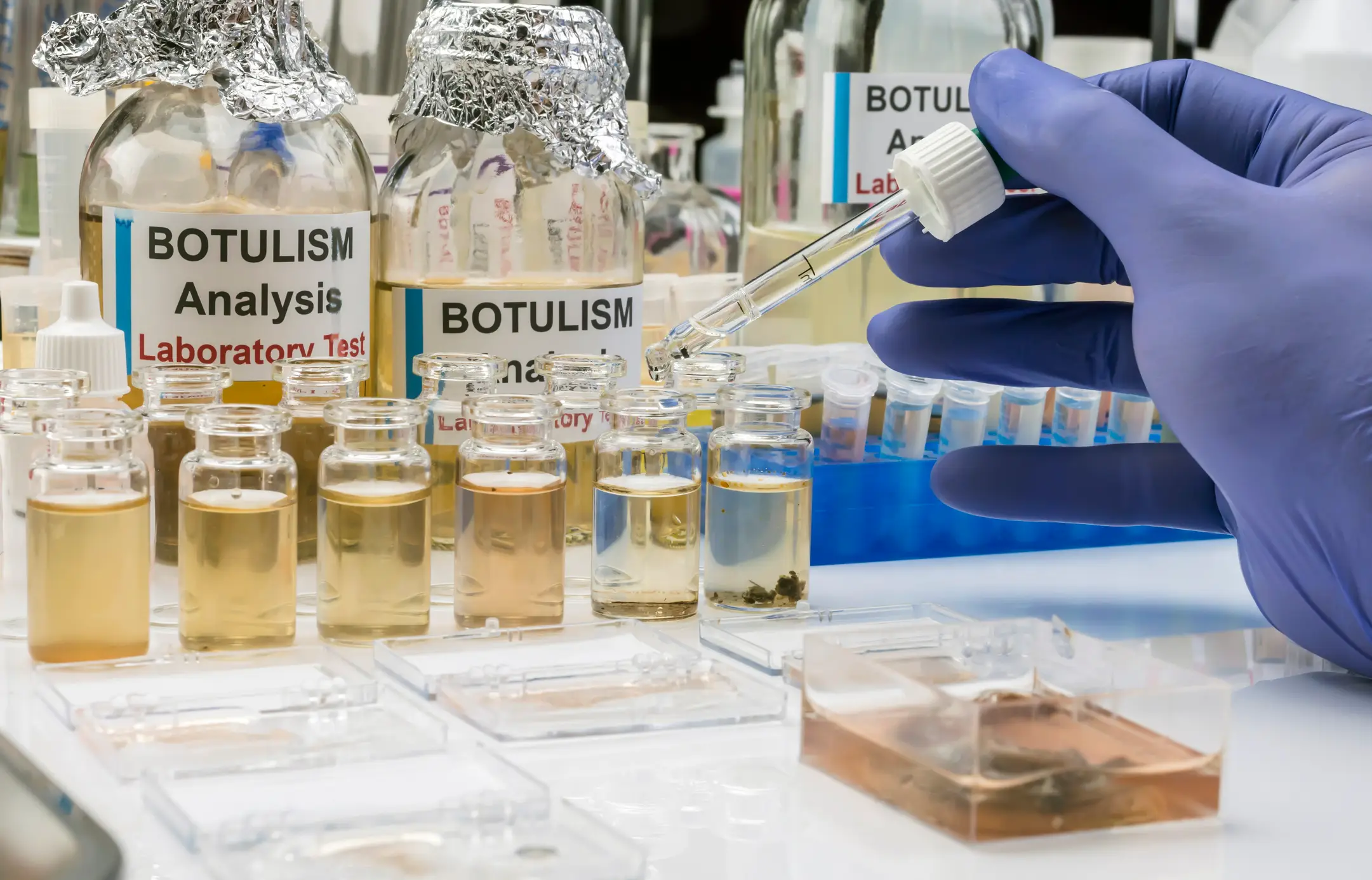 Botulism is treatable, but up to 10% of cases are fatal (digicomphoto/Getty Images)