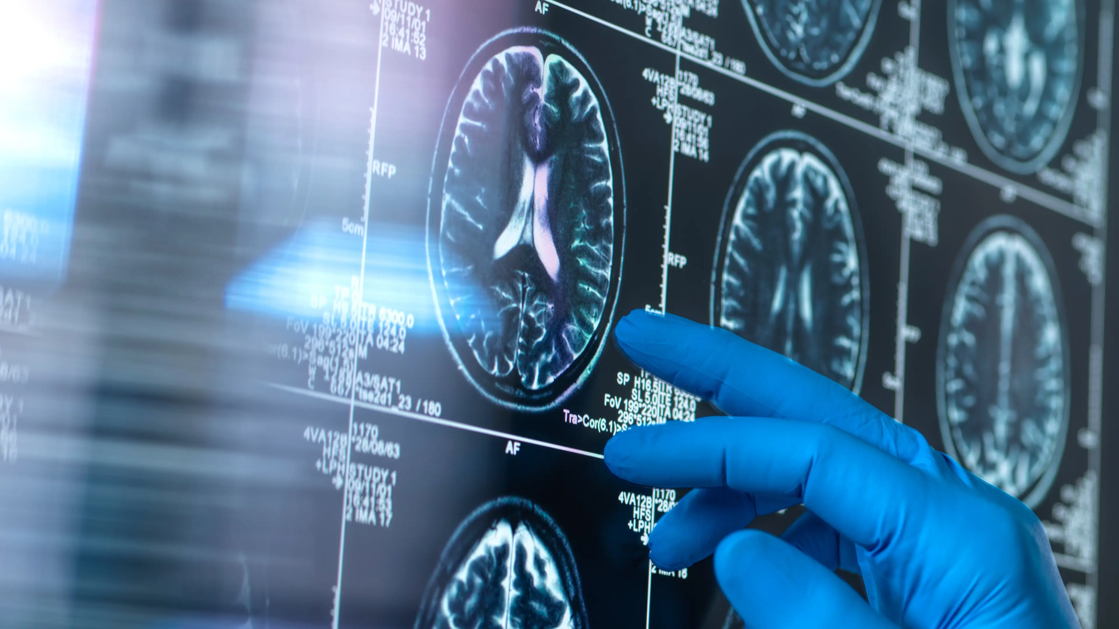 TEK IMAGE/SCIENCE PHOTO LIBRARY/Getty Images