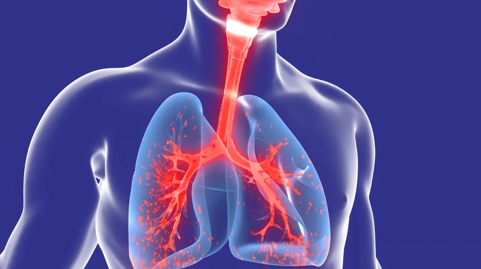 Silica dust from cutting engineered stone can cause irreversible lung damage (YouTube/Asbestos and Dust Diseases Research Institute)