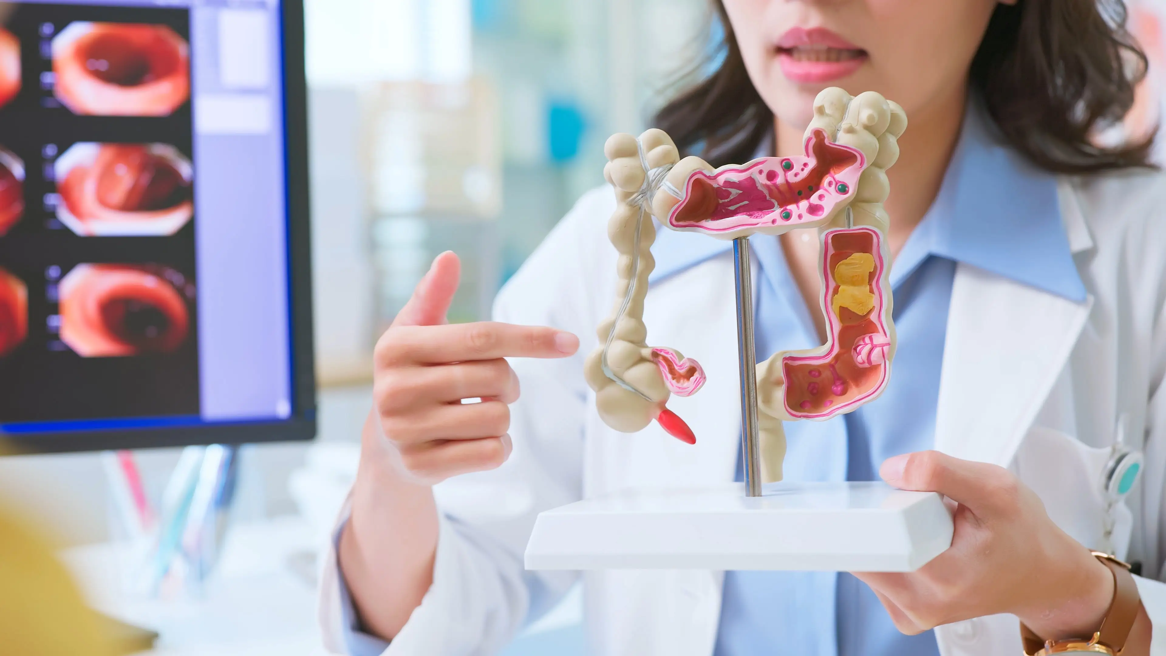 Doctors warn one common food habit is behind huge surge of colon cancer cases in Gen Z and Millennials