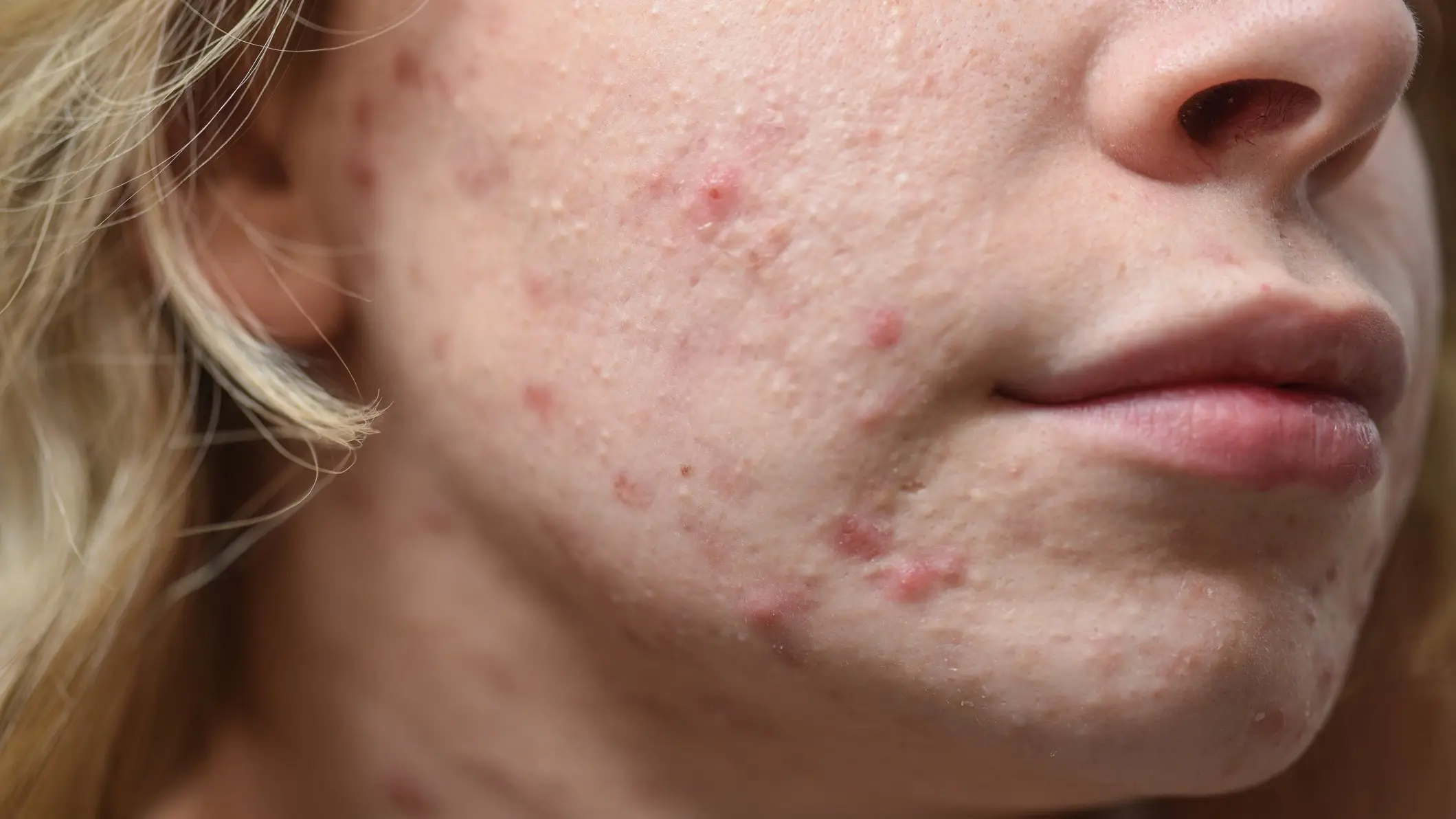 Expert says there is no wonder food for good skin