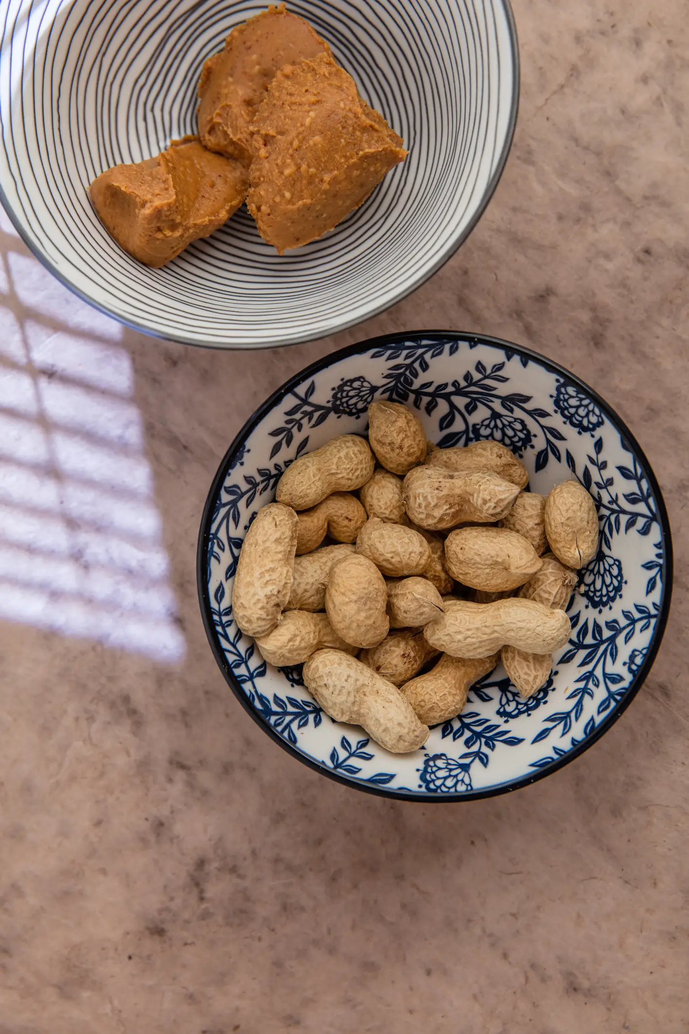 Peanuts are a common allergy trigger (annick vanderschelden photography/Getty Images)