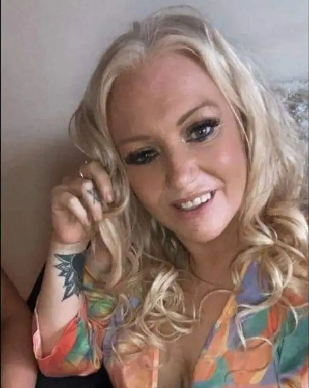 Kelly Allen opened up about her traumatic experiences after a sausage dog ripped a bit of her cheek off. (PA Real Life)