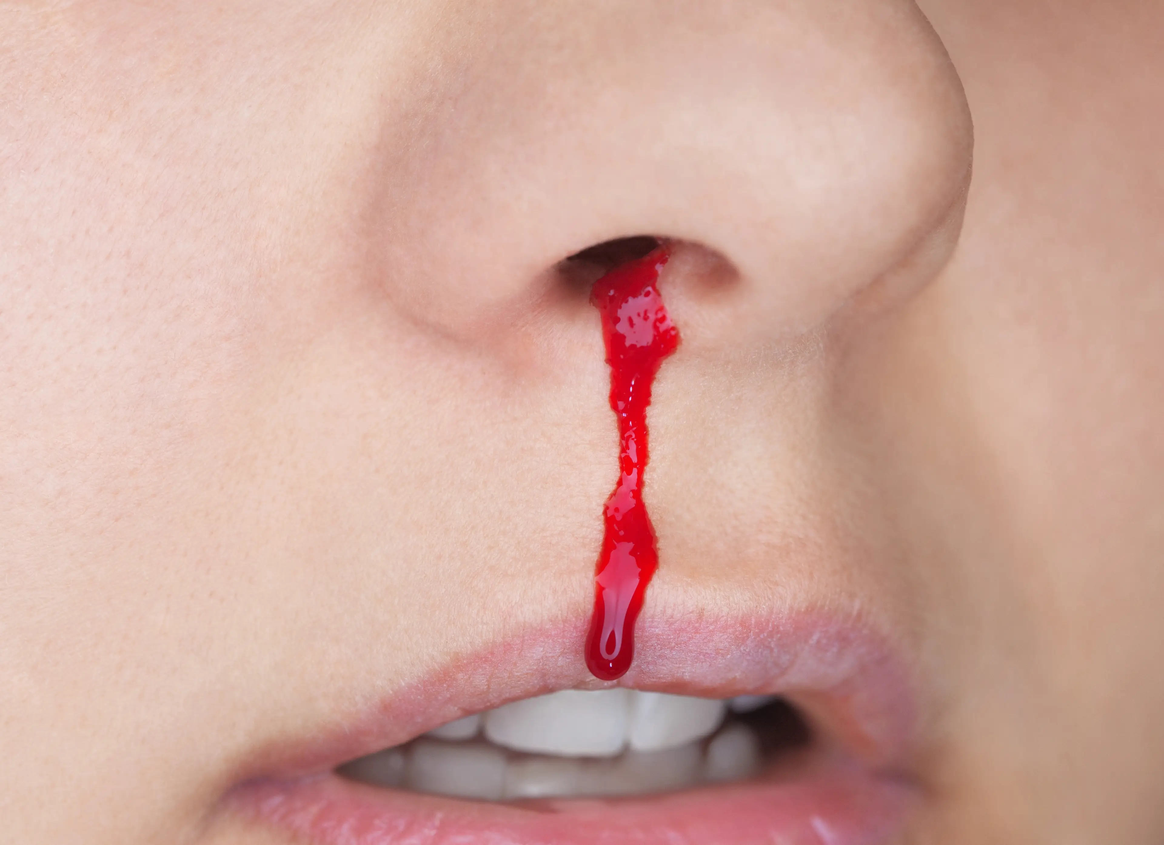 Some women claimed to experience nosebleeds regularly (Getty Stock Images)