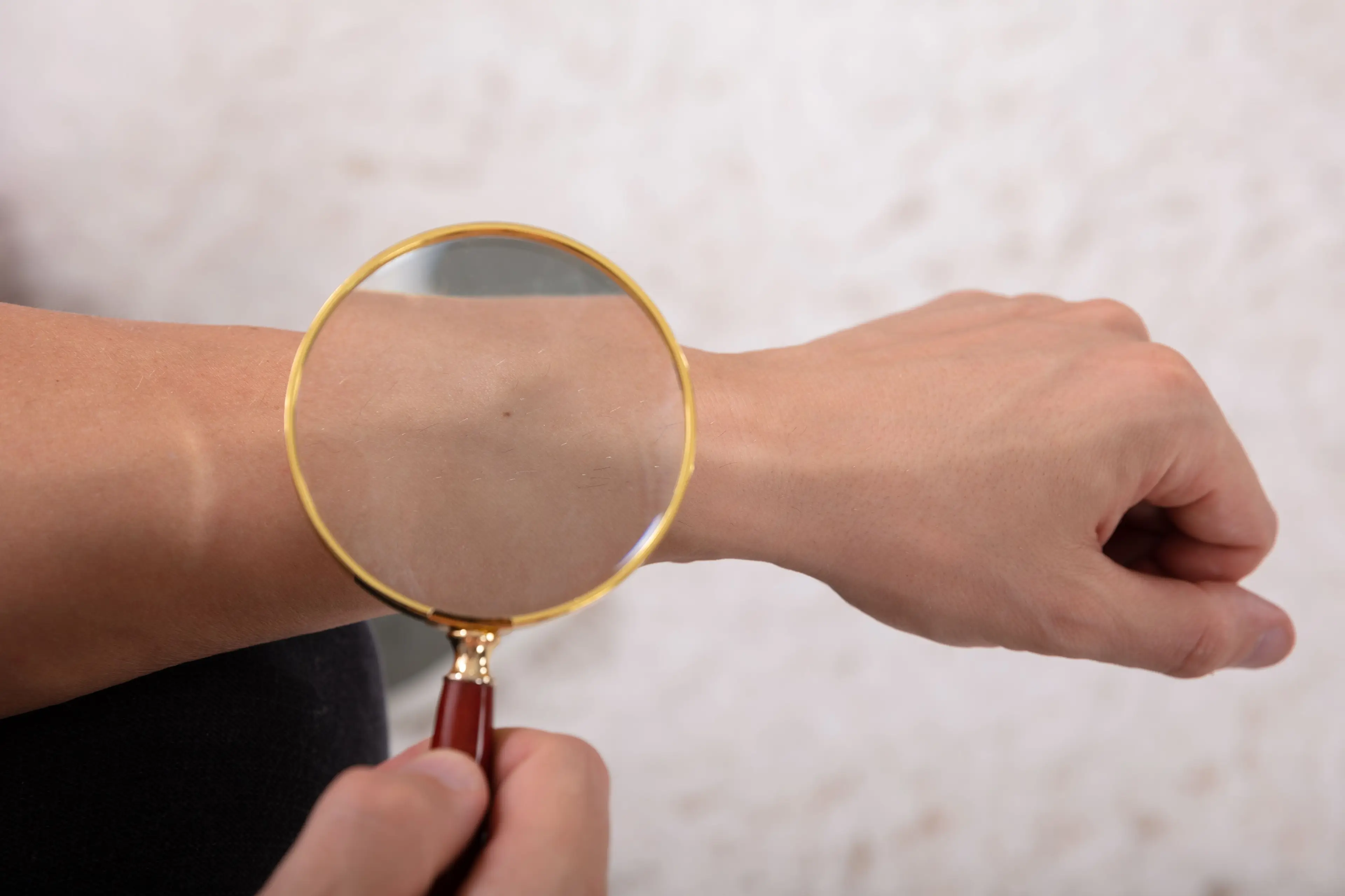 Moles are usually nothing to worry about (Getty Stock Image)