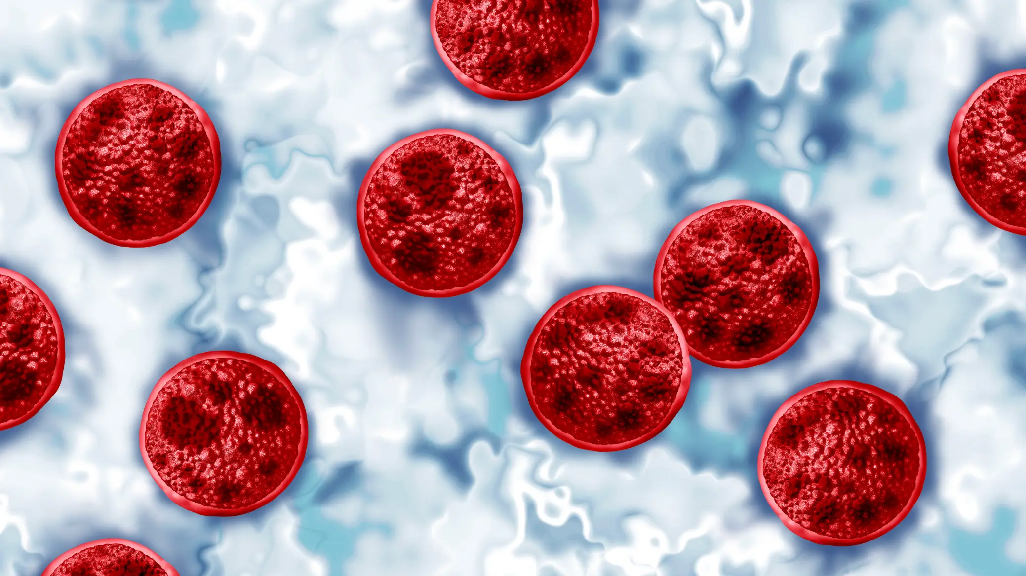 First deaths from the 'explosive diarrhoea' infection as cyclosporiasis outbreak spreads