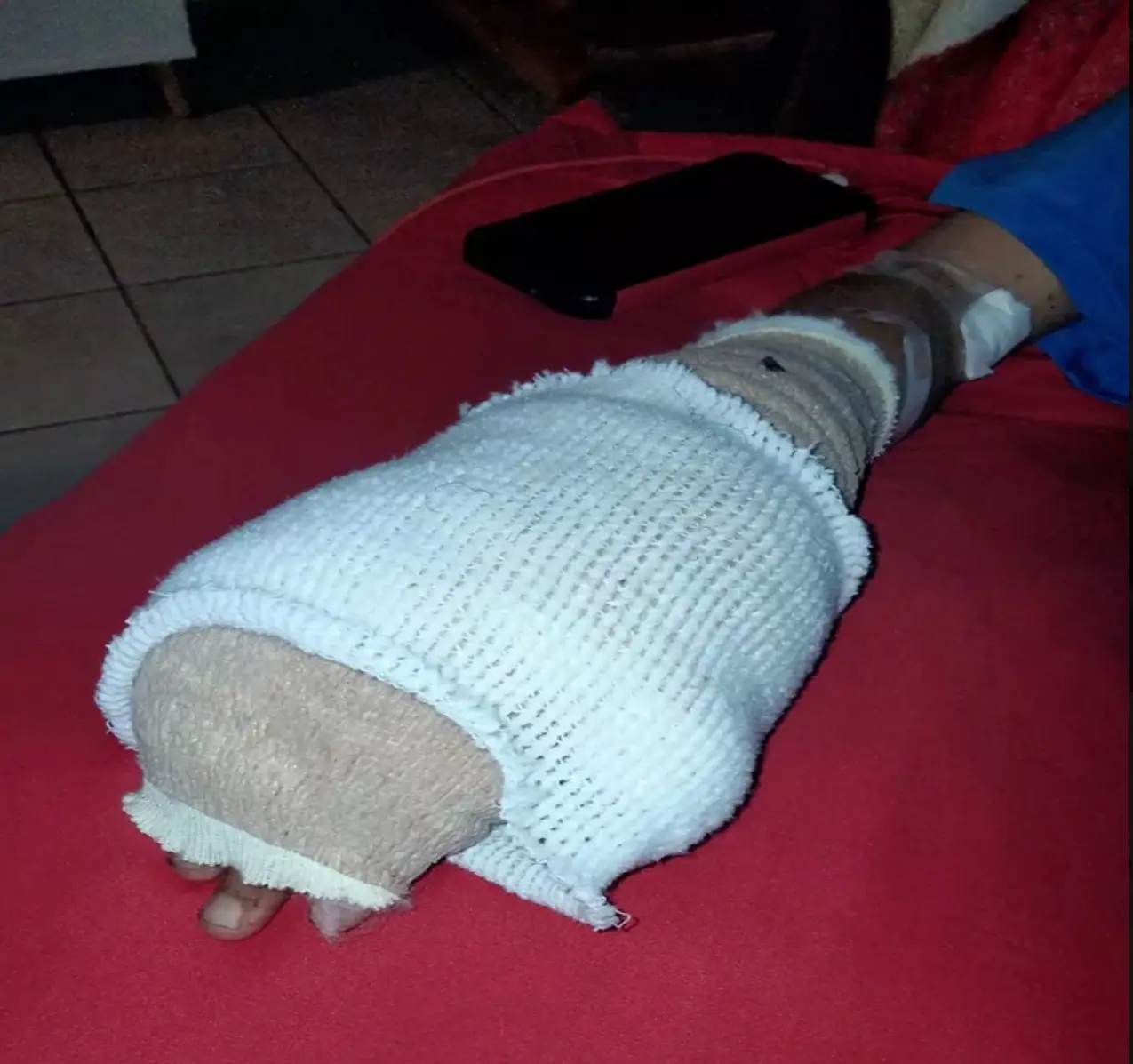 The damage will live with the teen forever (Kennedy)