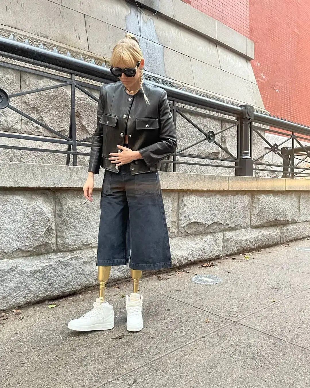 Lauren also suffered kidney failure and two heart attacks. (Instagram/@theimpossiblemuse)