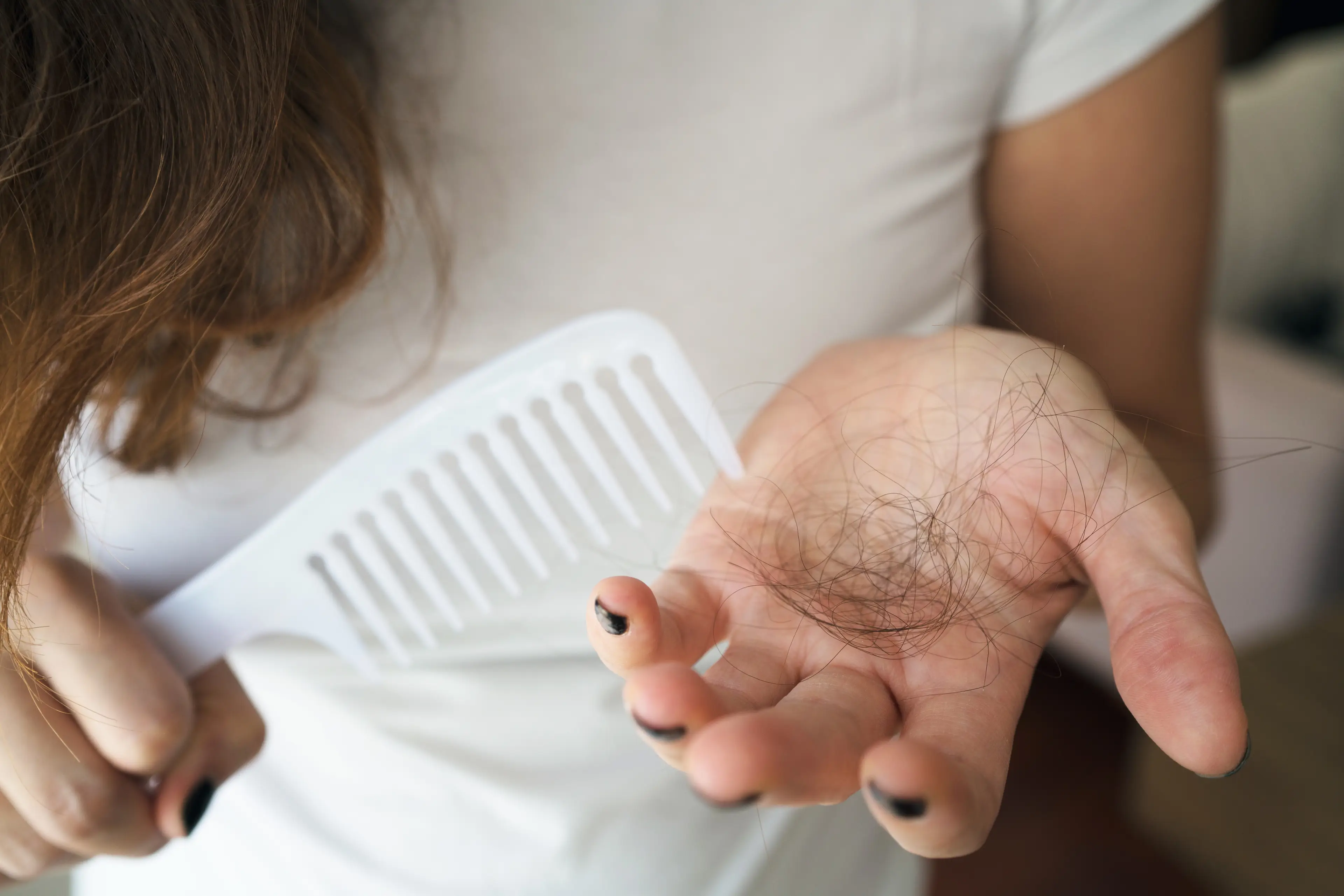 If you're suffering from increased hair loss, your hat or summer hairstyle could be to blame (Getty stock)