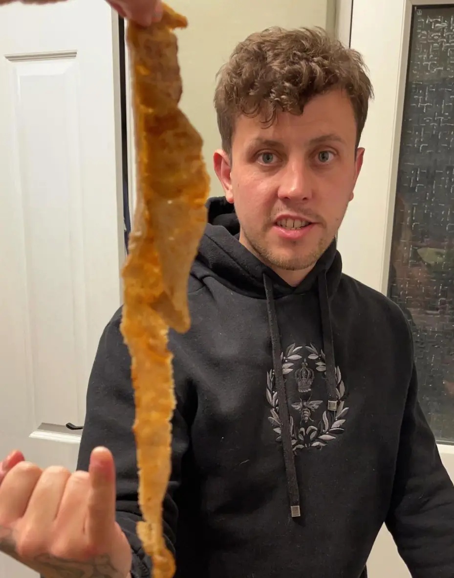 Nat was struck by a car in Leeds. (