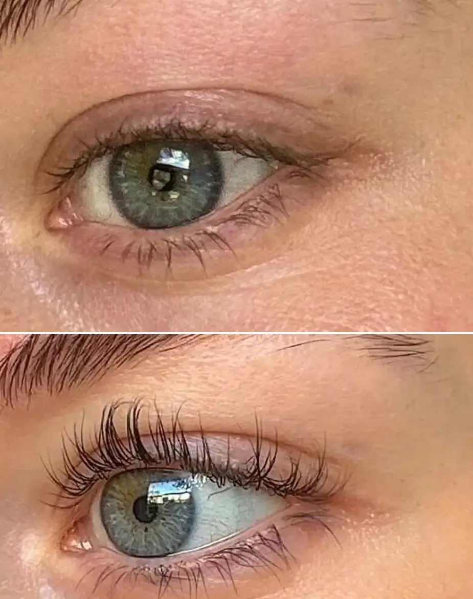 The before and after photos are impressive.