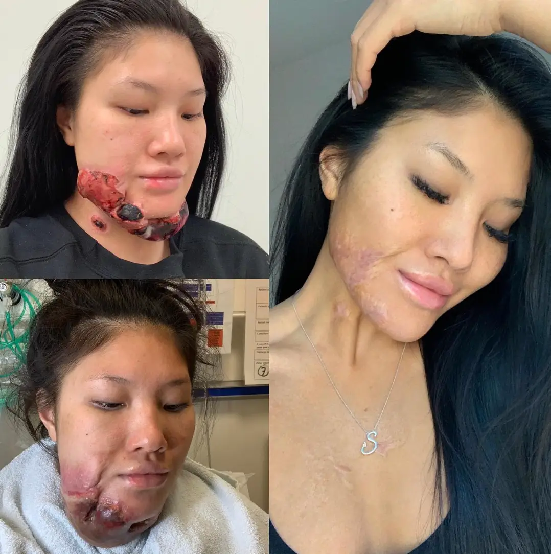 Sophie said her pain was the making of her.