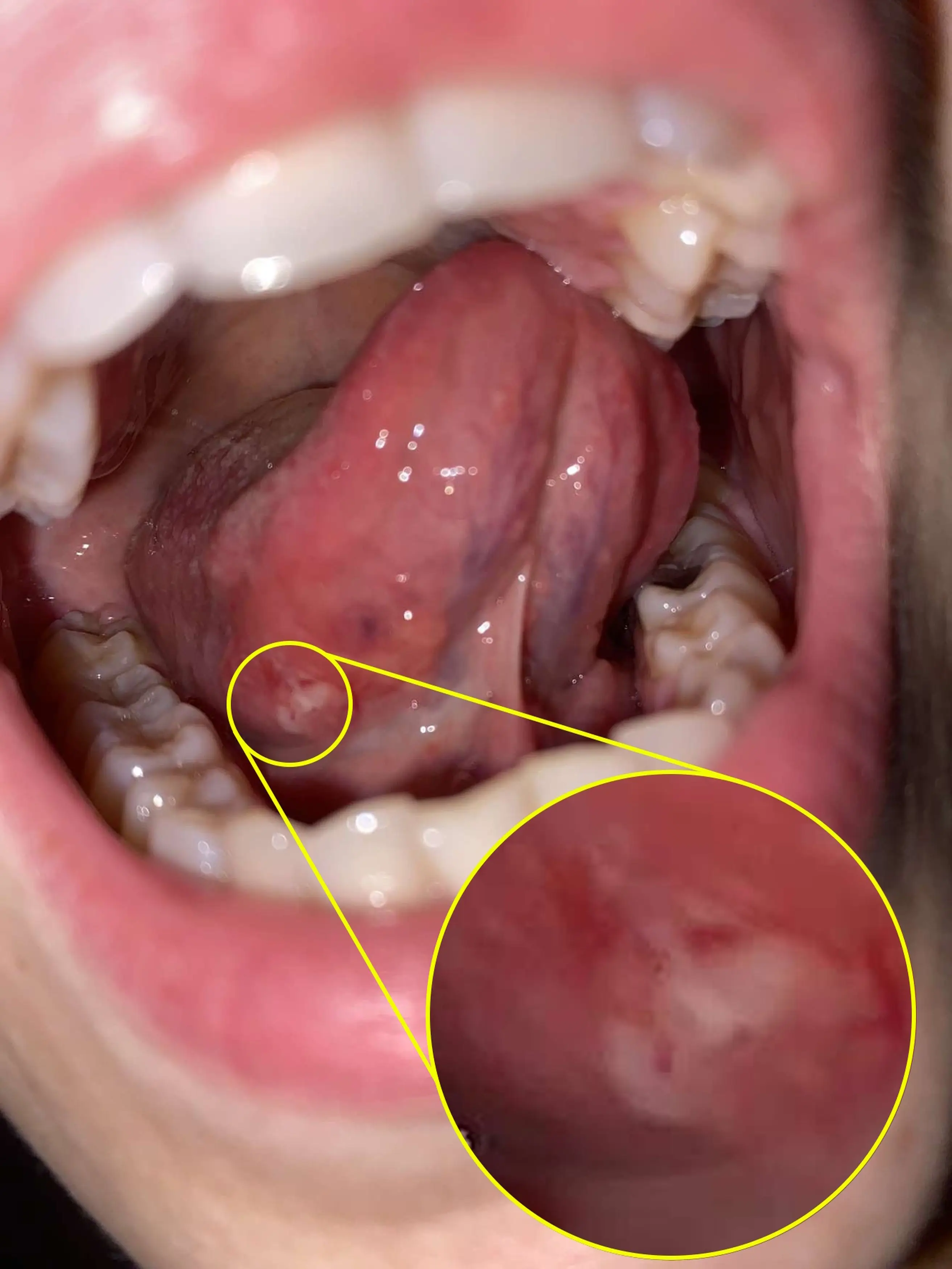 It was cancer (Kennedy News and Media)
