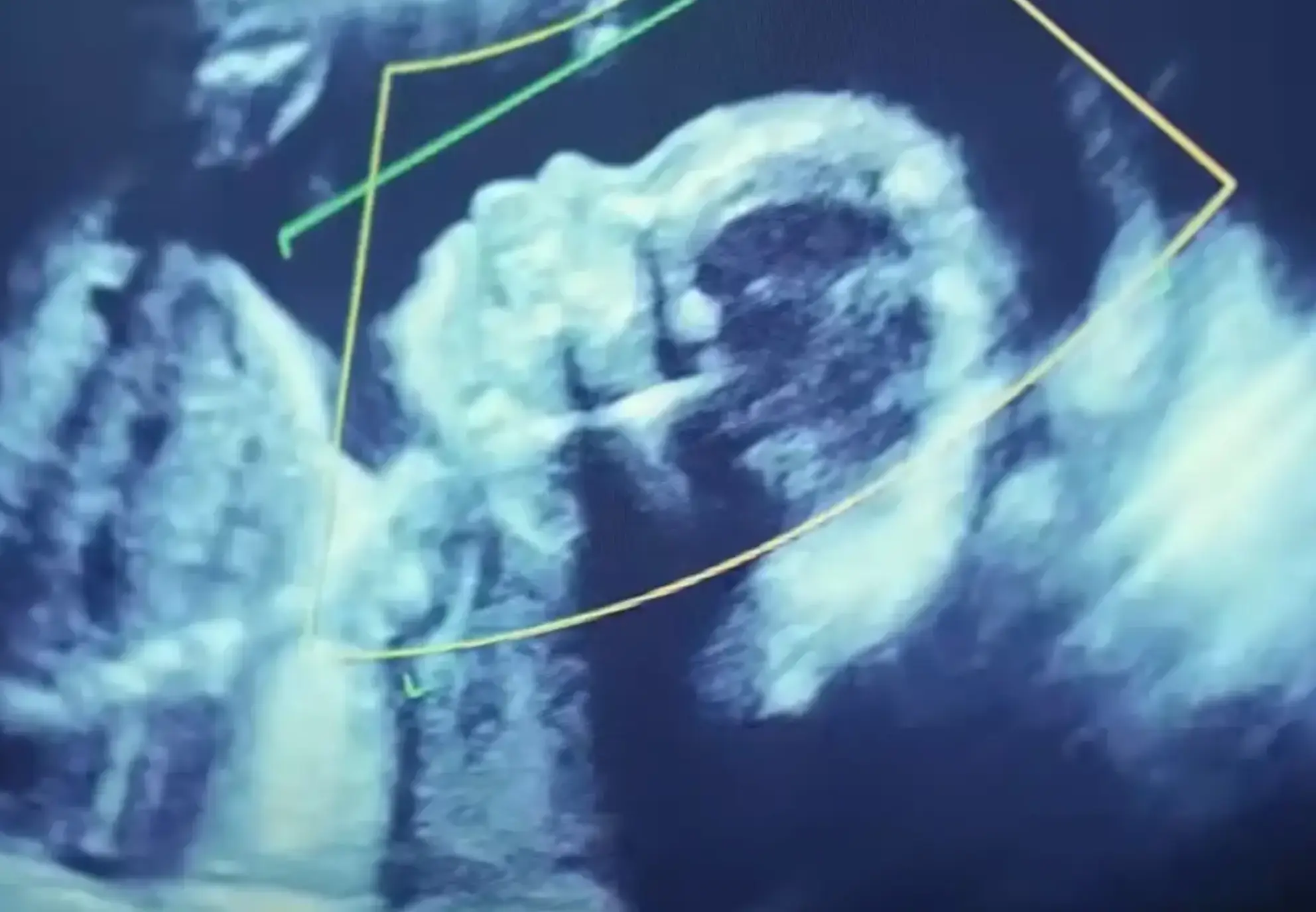 Meijer would introduce himself to prospective parents and it soon came to light that he had been telling lies. (Netflix)