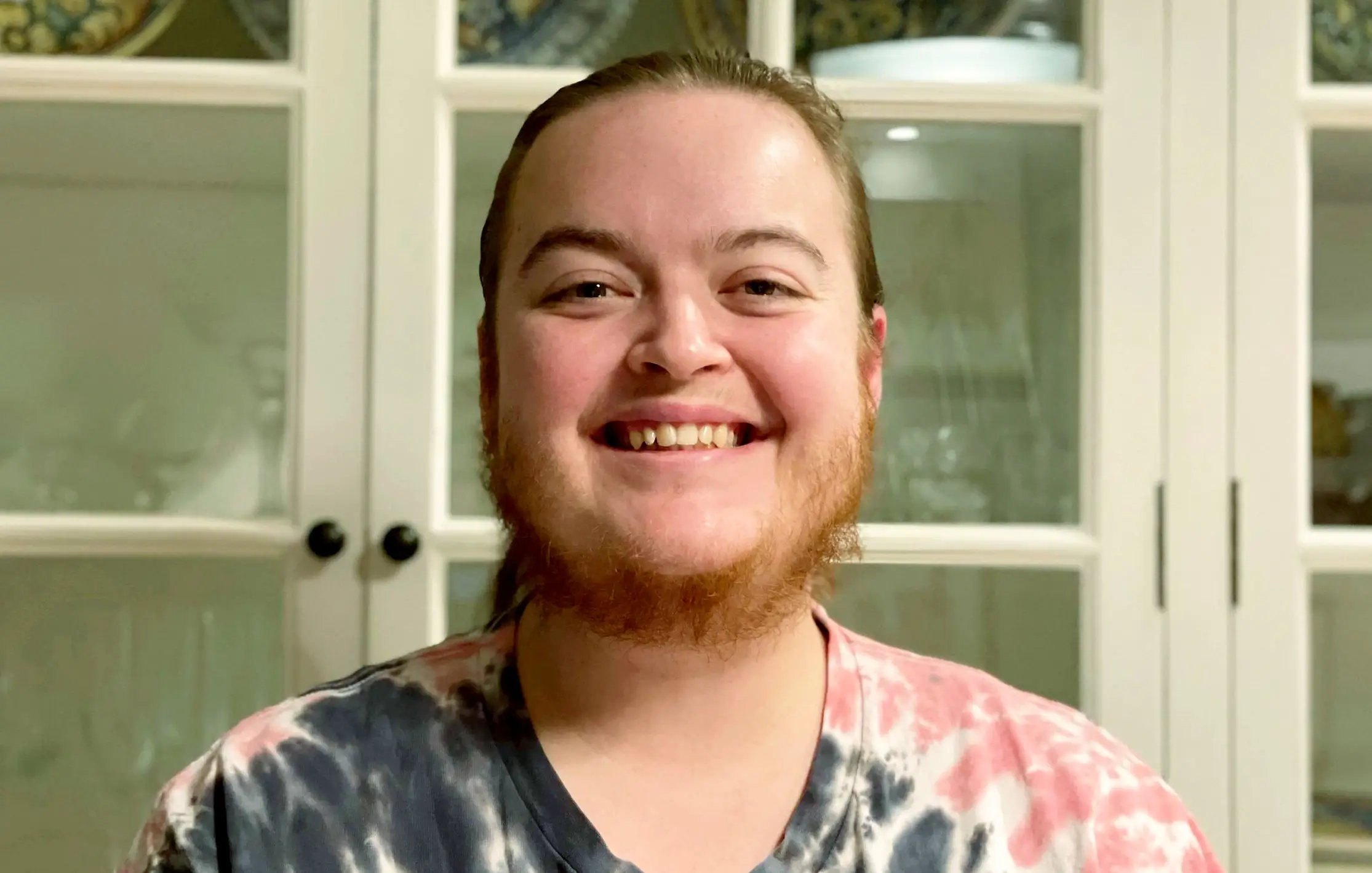 Morgan Colenan finally feels free now she's allowed her facial hair to grow naturally.