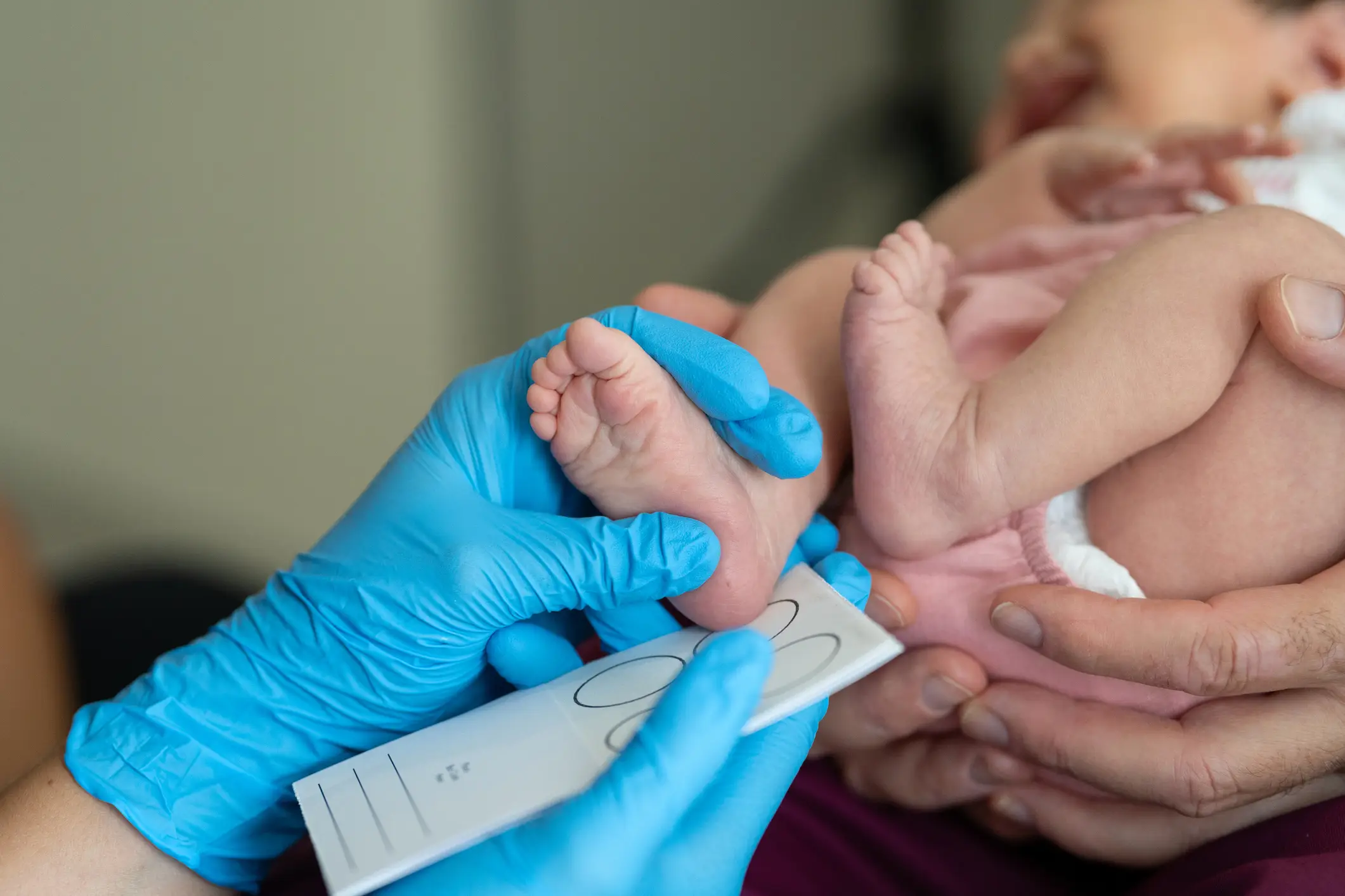 There are signs to look out for in babies, too (Getty Stock Image)
