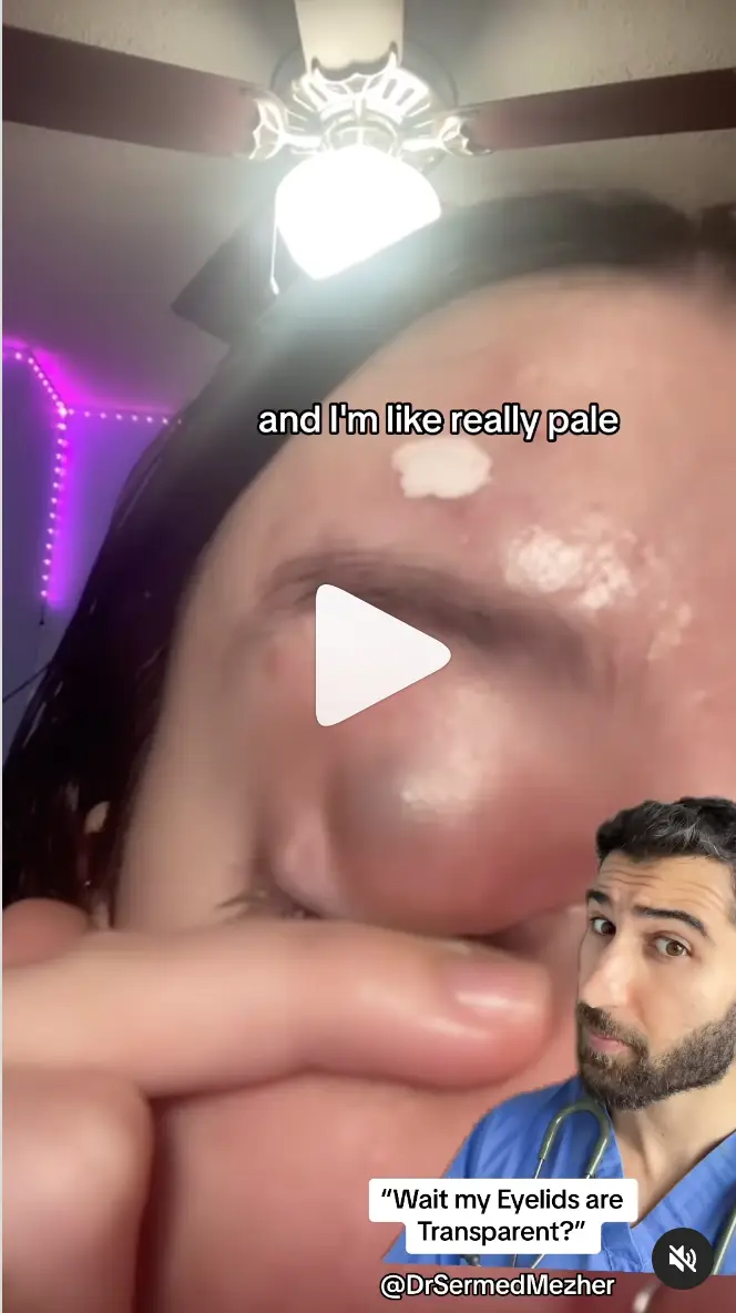 People were stunned to discover eyelids are 'transparent' (drsermedmezher/instagram)