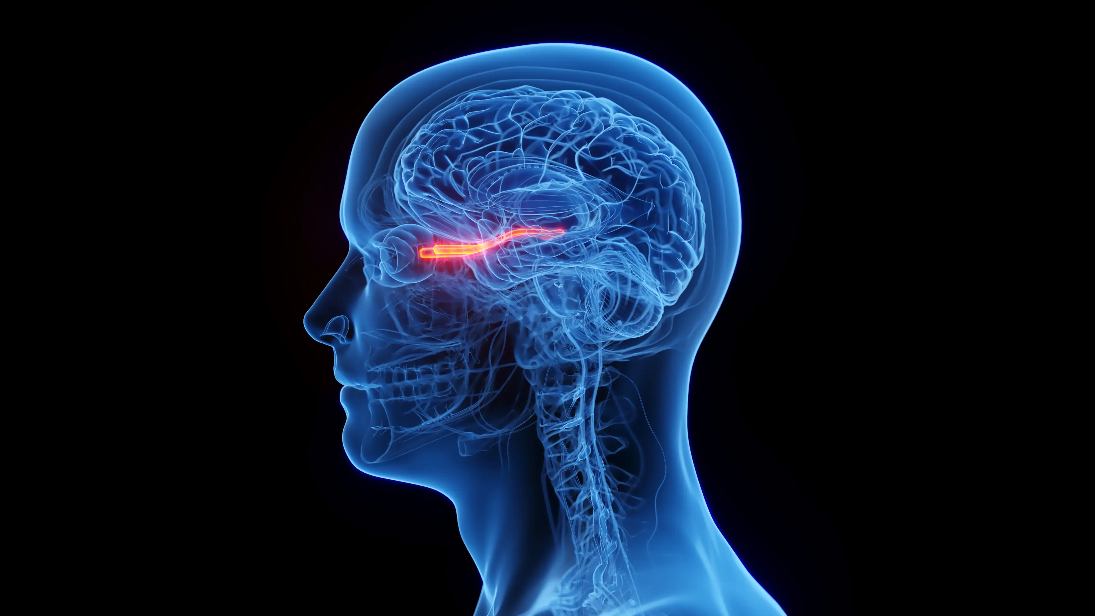 It occurs when blood is cut off from the optic nerve due to inflammation (Getty Stock Images)