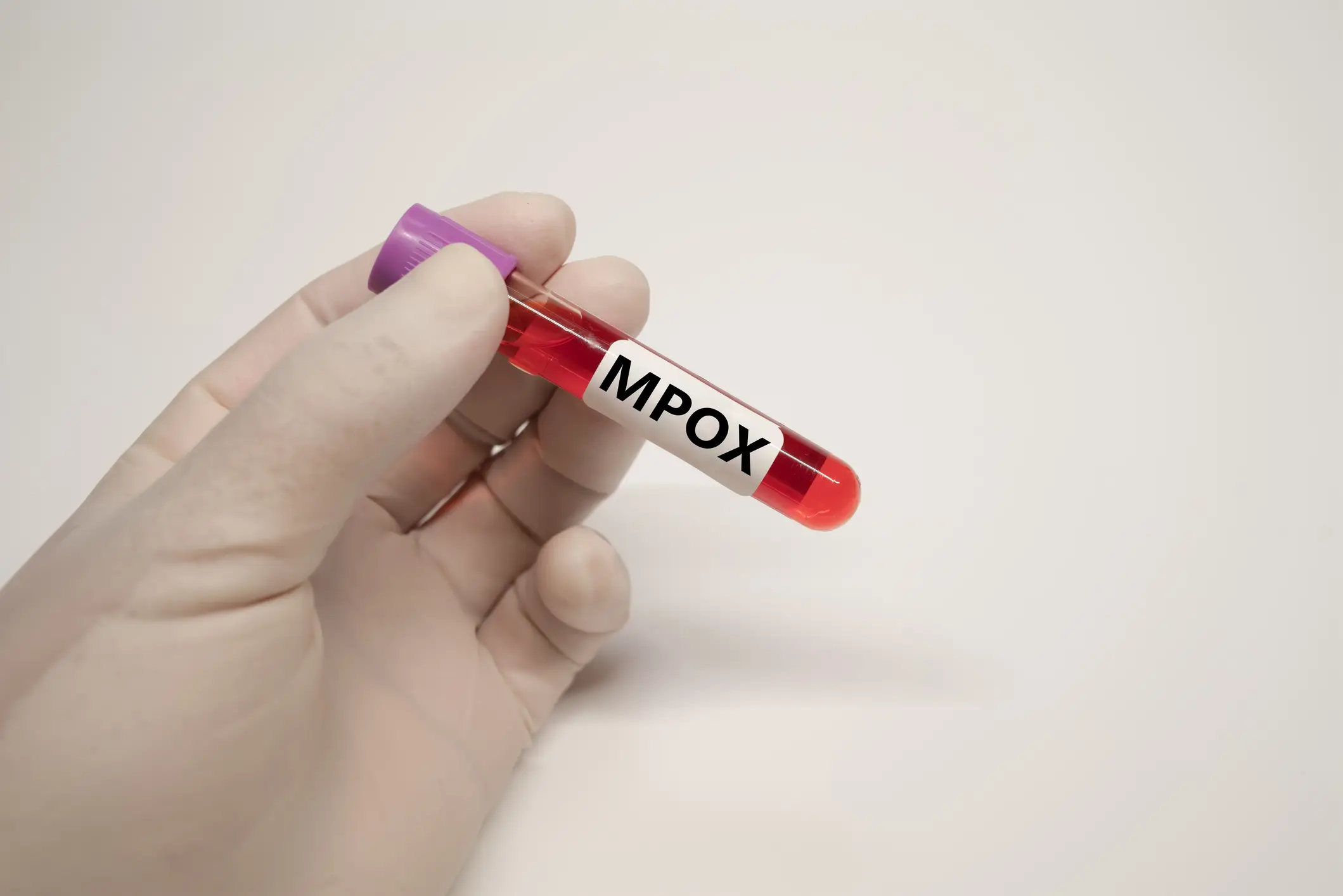 Mpox was originally seen in monkeys before being spread onto humans. (Getty Stock Image)