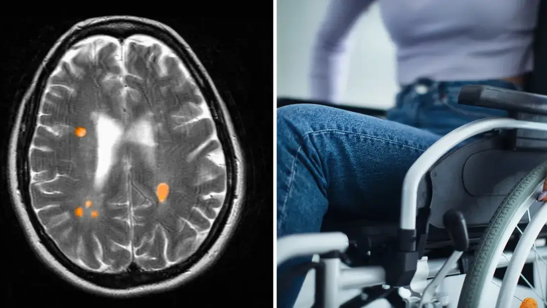 Scientists discover one behaviour that could lead to MS later in life