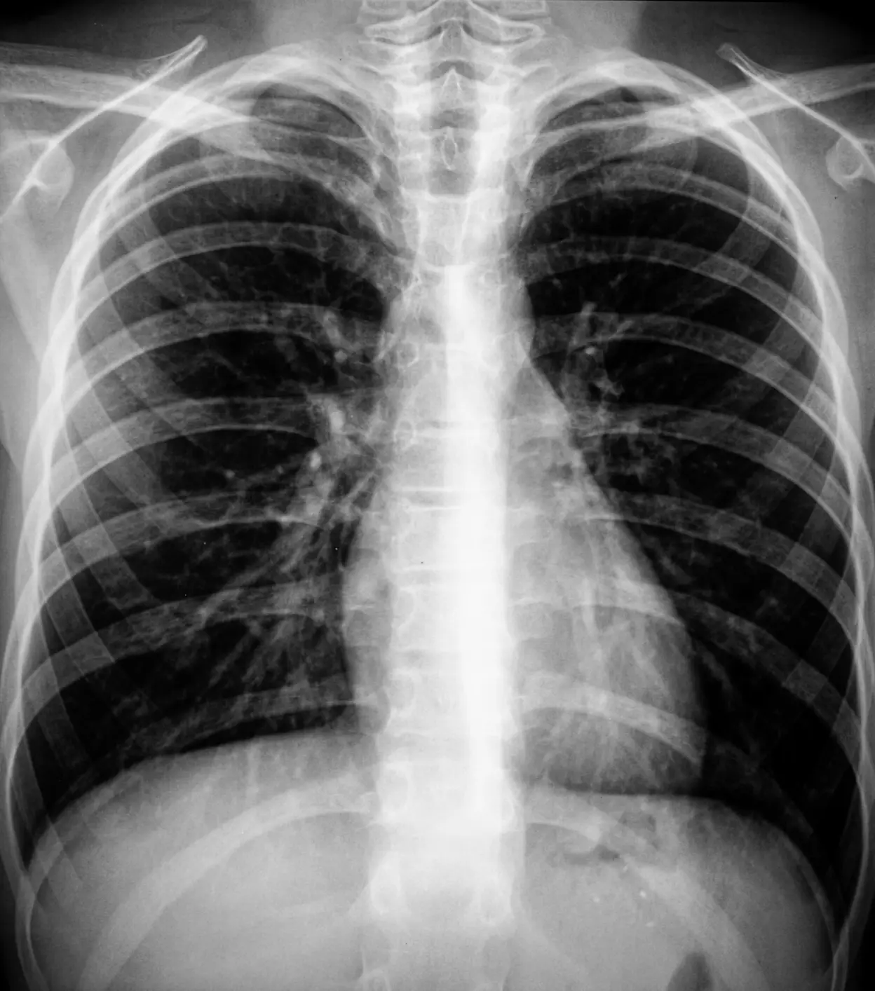 A doctor has revealed the one way to the painful and unpleasant side effect (Getty Stock Image)