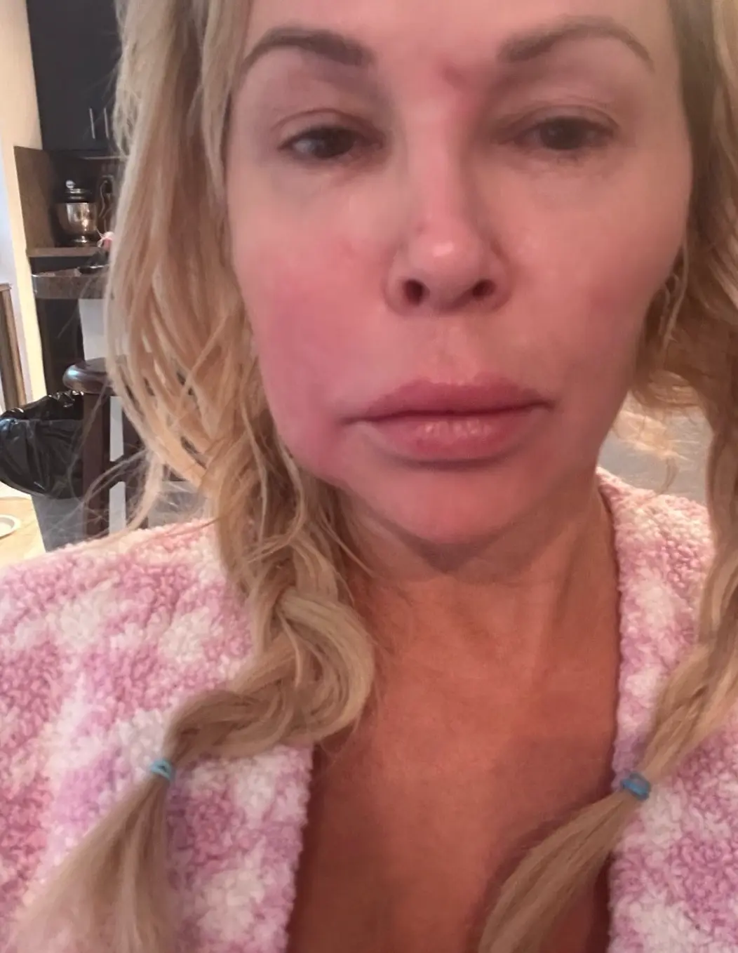 Glanville is having facial surgery to investigate her ongoing health issues (Instagram/@brandiglanville)