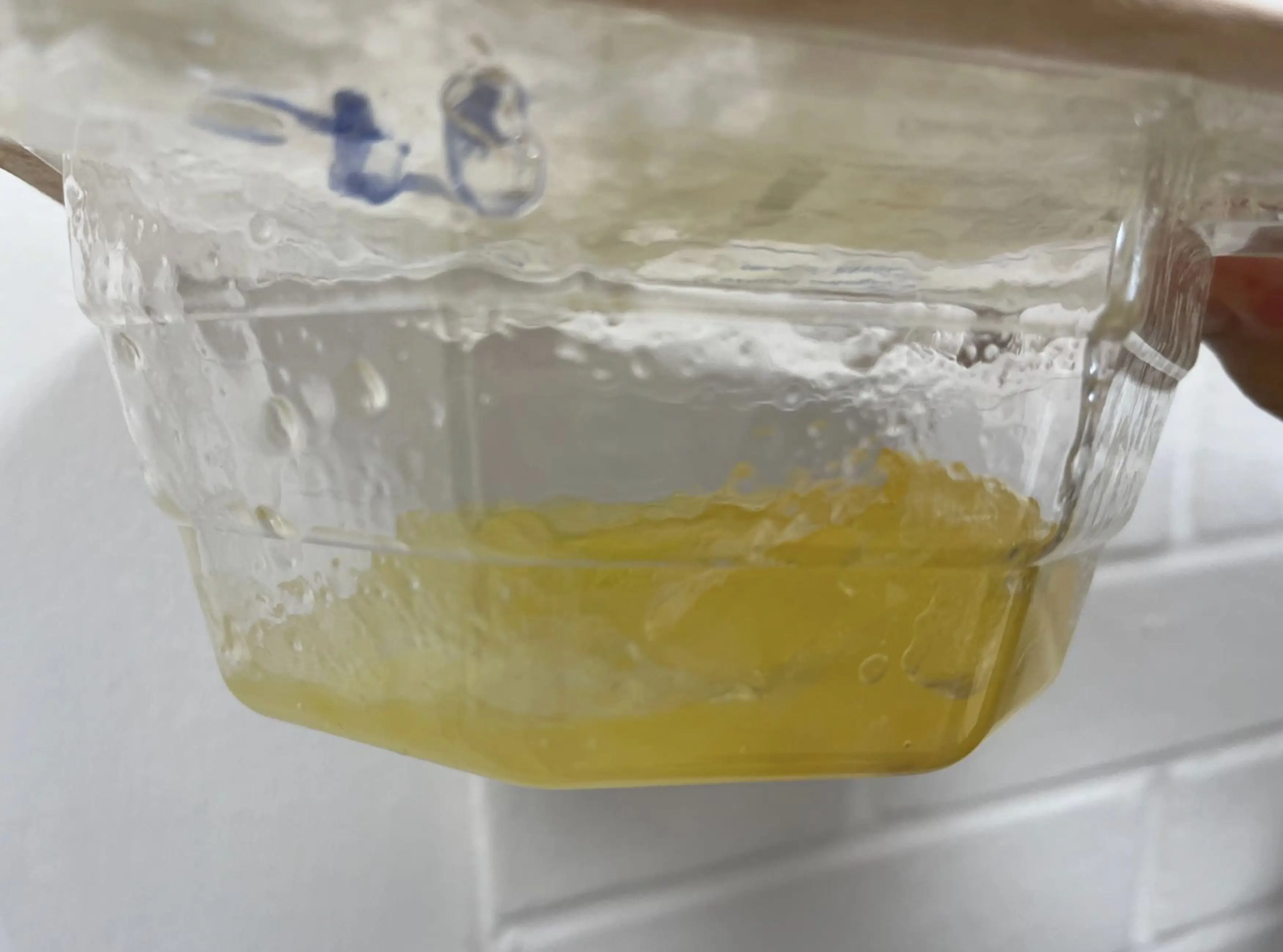 One of Gardiner's breast implants previously ruptured (Kennedy News and Media)