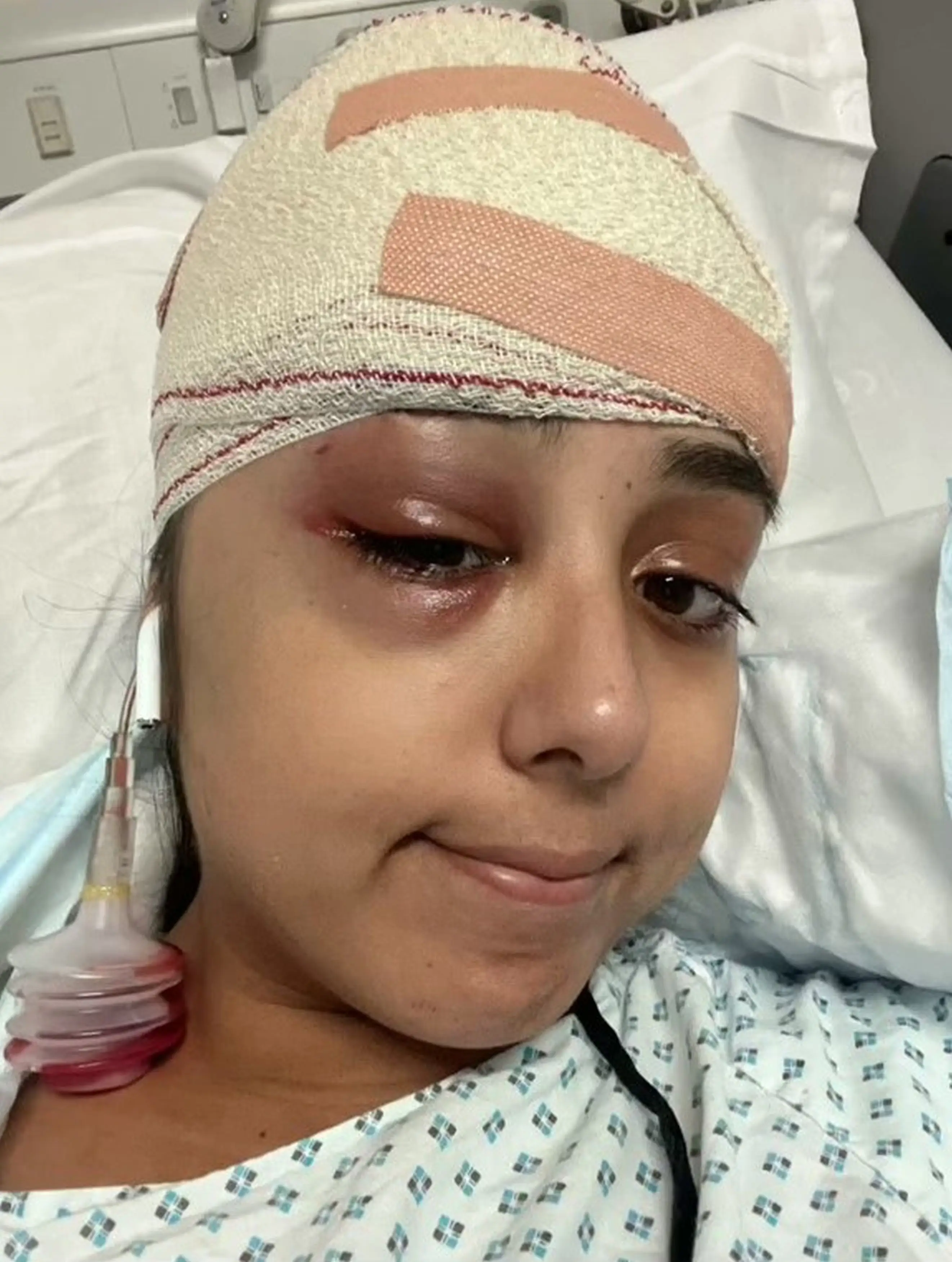 A woman whose hair clip sliced through her head after a car crash was fearful she was going to die.