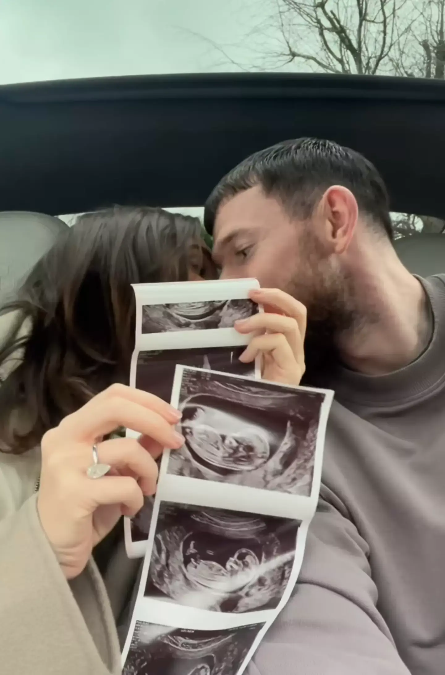 People have praised her for being so open. meganmckenna/Instagram