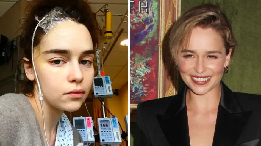 Emilia Clarke Is Missing 'Quite A Bit' Of Her Brain After Surviving Two Aneurysms