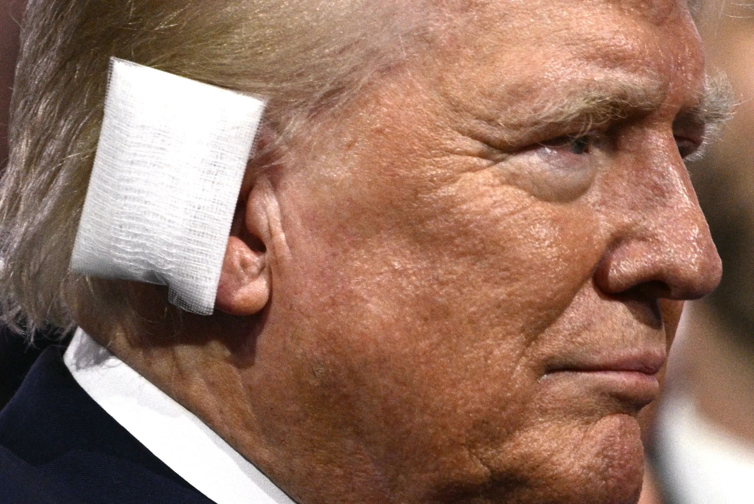 It does seem like an oddly placed plaster (Brendan Smialowski/AFP via Getty Images)