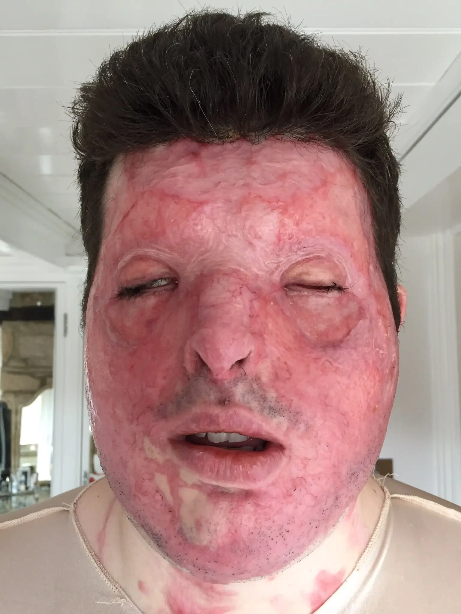 He suffered severe injuries (Supplied)