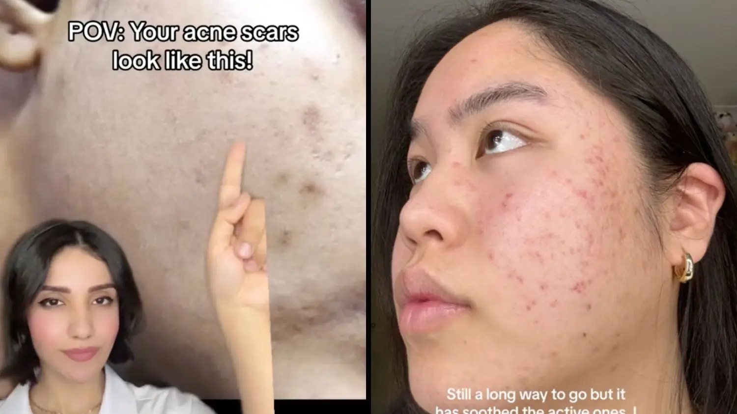 TikTok/@dr.farzan/@sarahtrvn