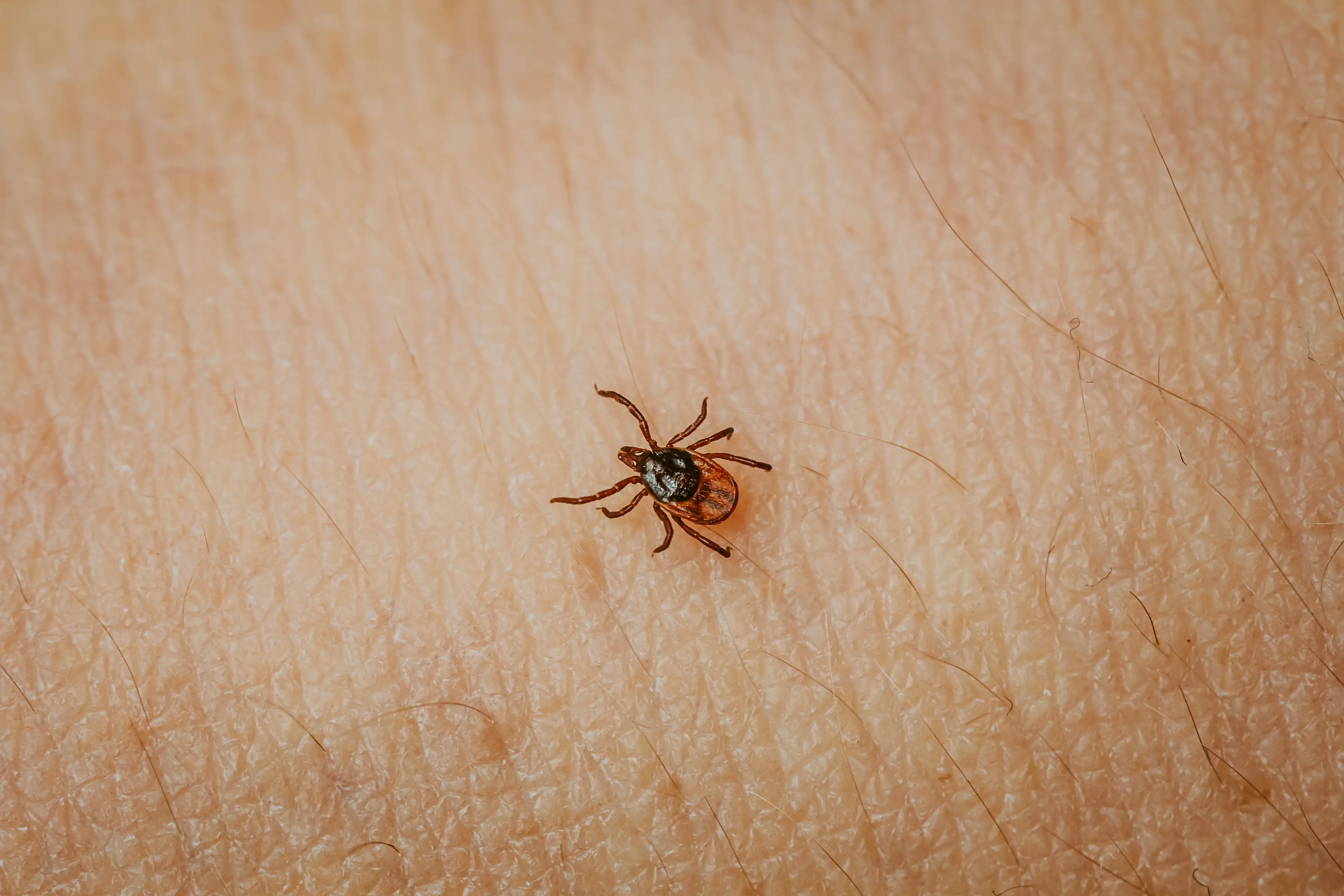 The disease is contracted through a tick bite. (rbkomar/Getty)