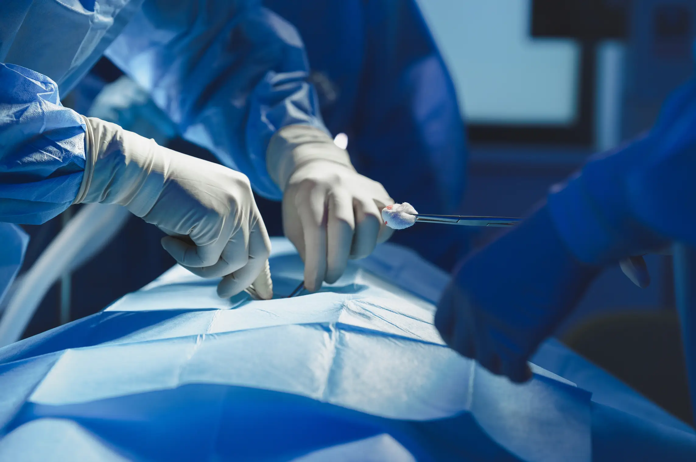 In some cases, surgery might be necessary to remove the cyst (Getty Stock Images)