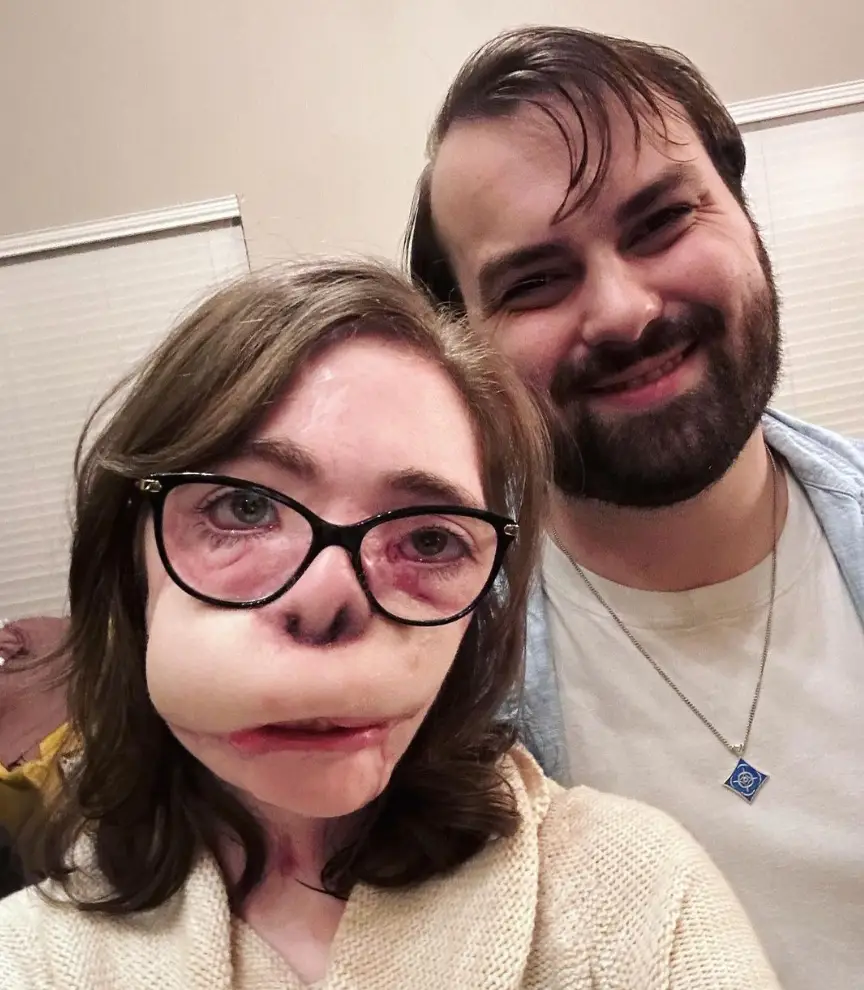 Durand's boyfriend has helped her stay strong since the accident.