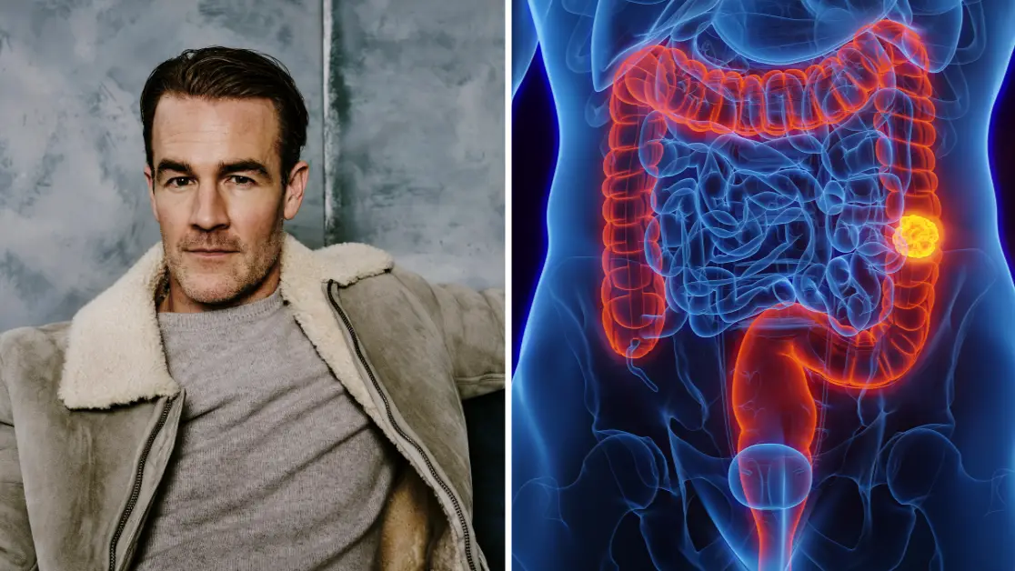 Michael Buckner/Deadline/Penske Media via Getty Images/Getty stock image