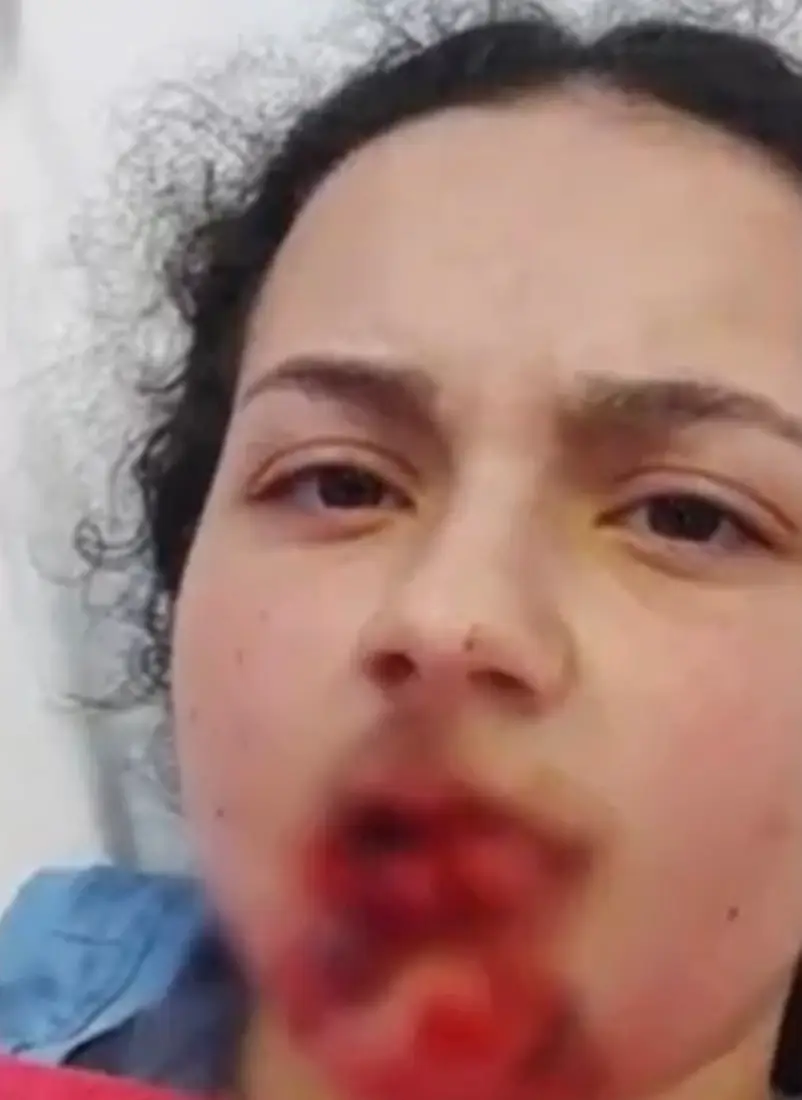 Niki has been left with devastating injuries.