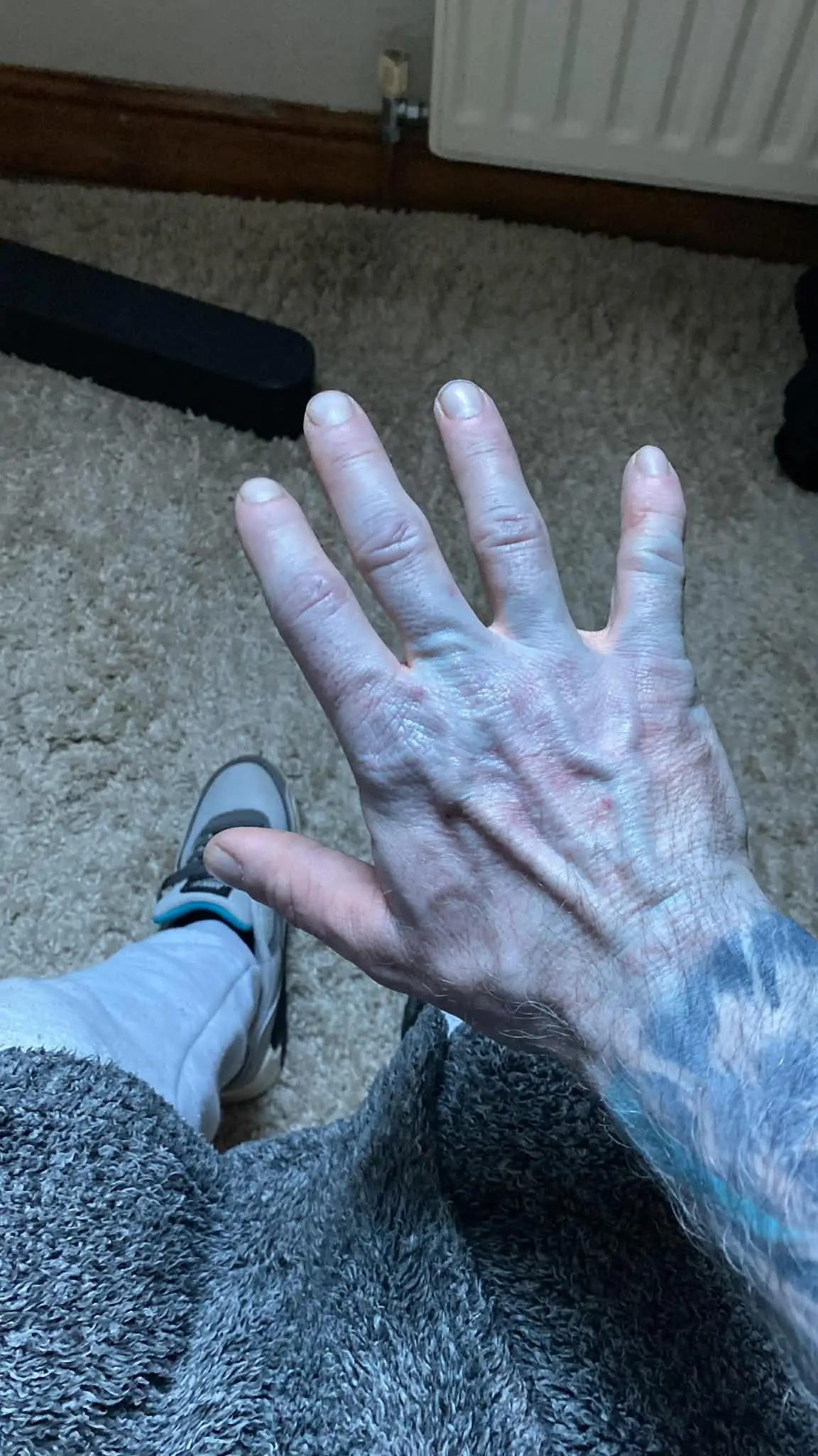 One British man was seriously alarmed after waking up with blue skin (SWNS)