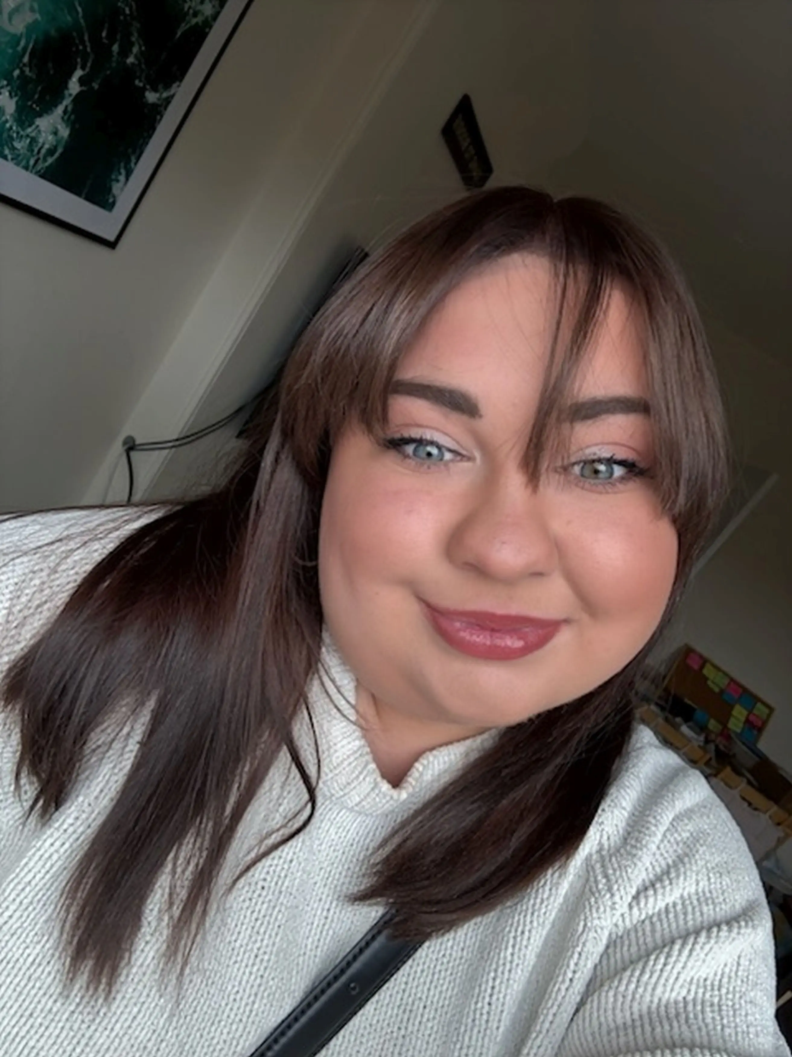 Hannah was diagnosed with the rare condition in March of this year (Kennedy News and Media)