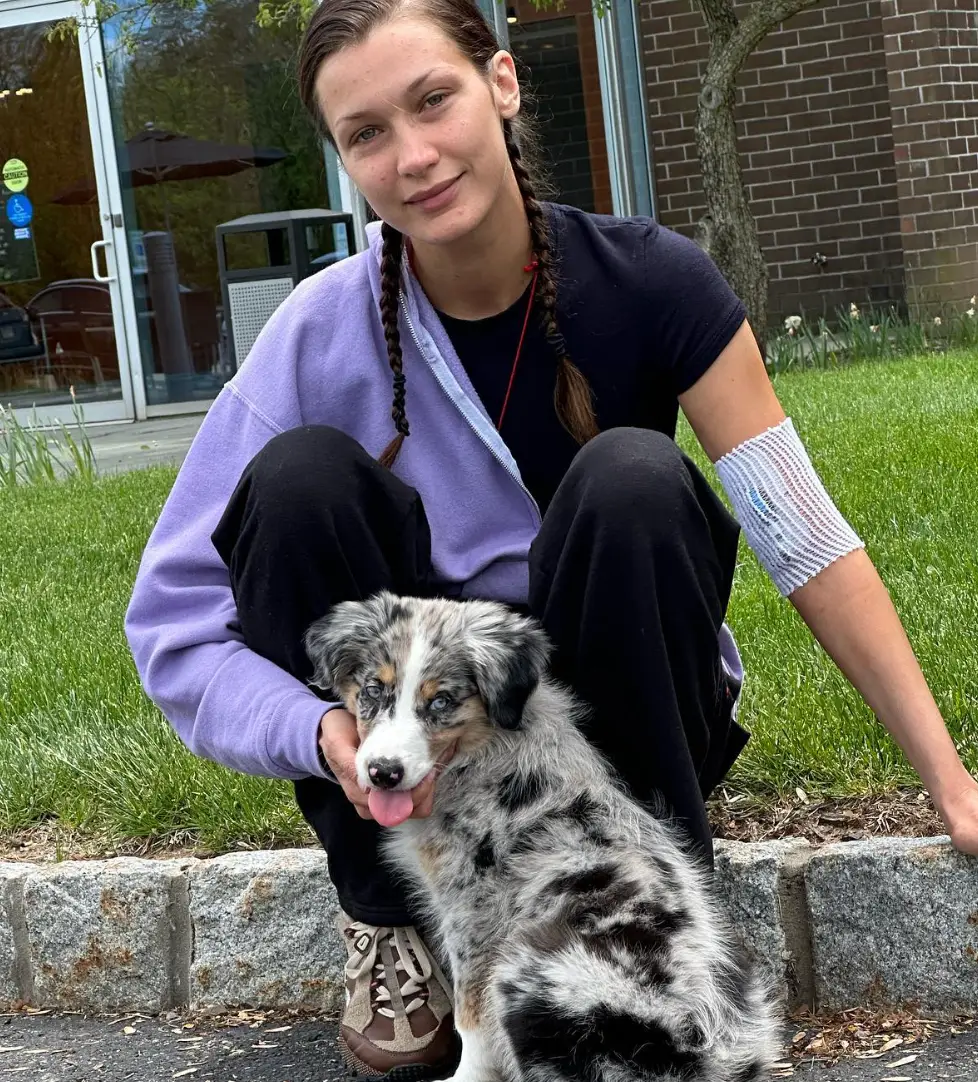 Bella Hadid has previous gotten candid about her health (Instagram/@bellahadid)