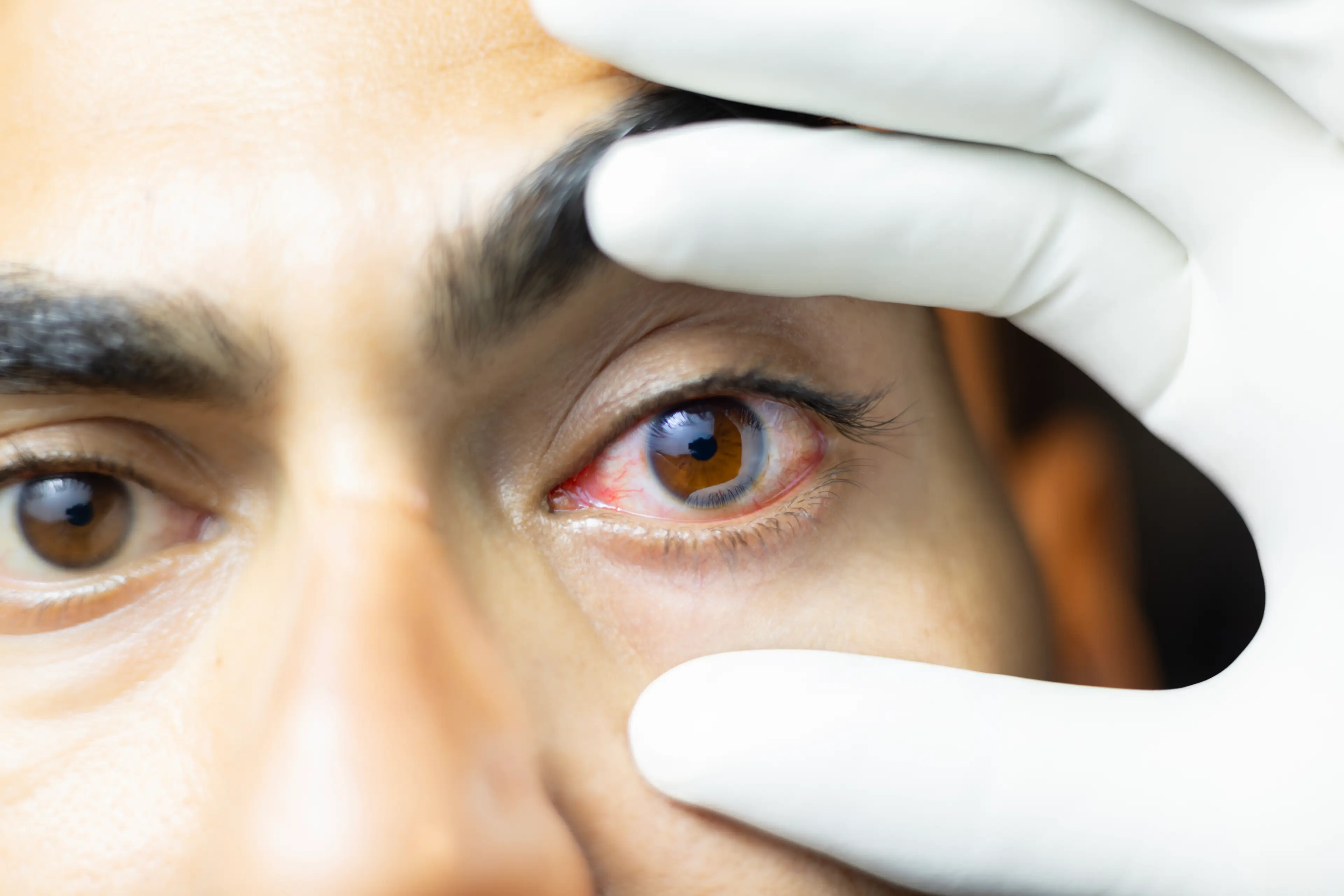 An eye doctor recently hosted a Reddit AMA to dispel several 'myths' (Uma Shankar sharma/Getty Images)