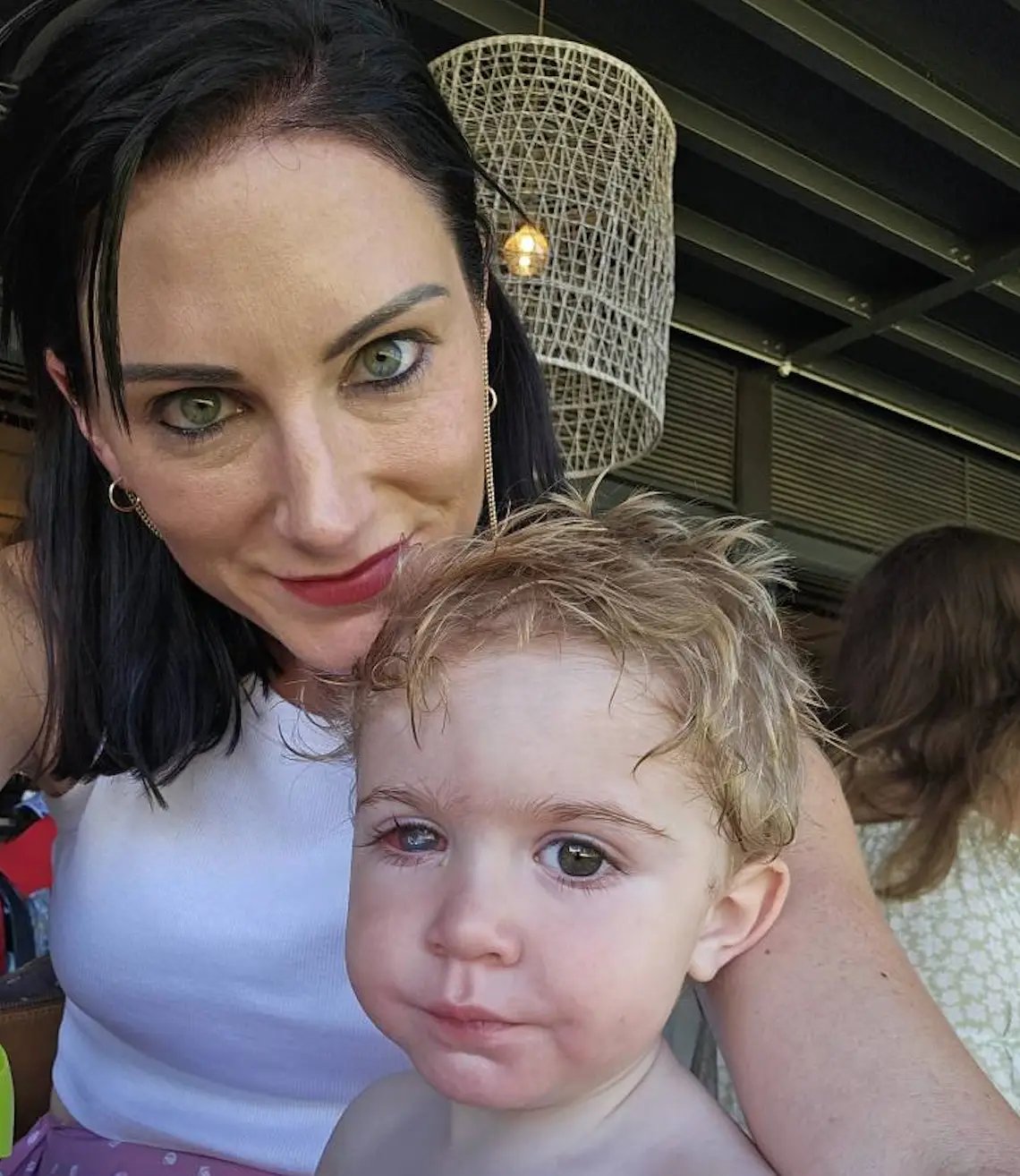 A mother has warned against kissing other people's babies after her son contracted herpes in his eyeball (Facebook/Michelle Saaiman)