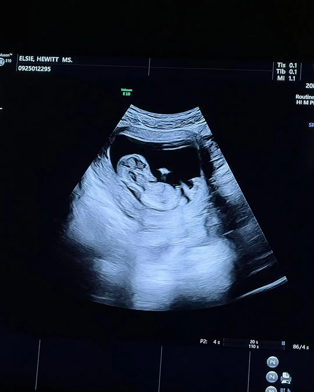 Elsie shared a number of sweets snaps to social media in the announcement post (Instagram/@elsie)