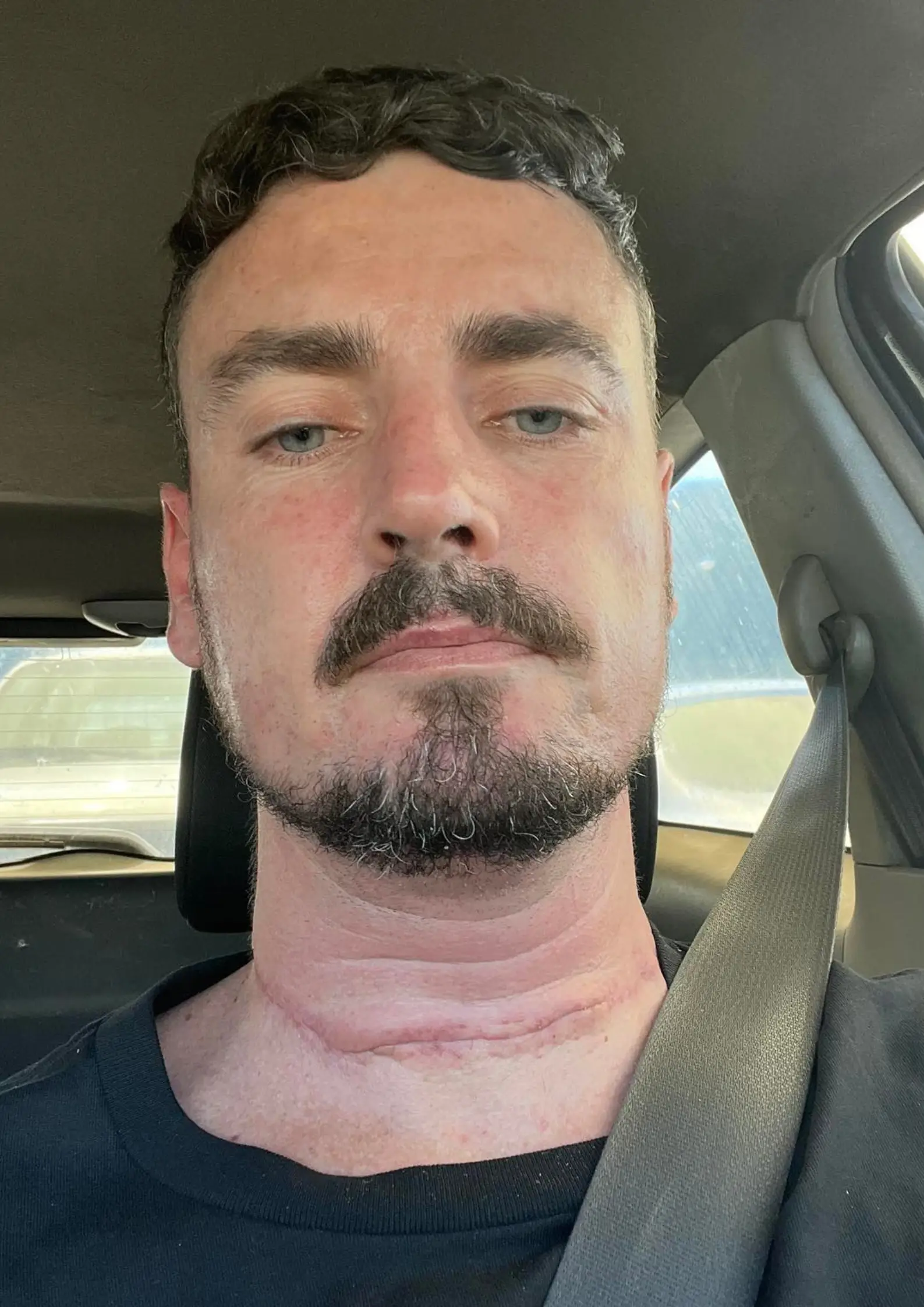 Nicko was told he only had six months to live.